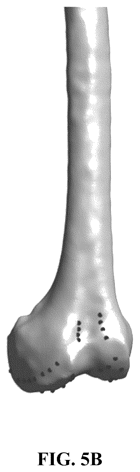 Patent US12551284 Figure 7 – Implant design optimization for geometric uncertainty