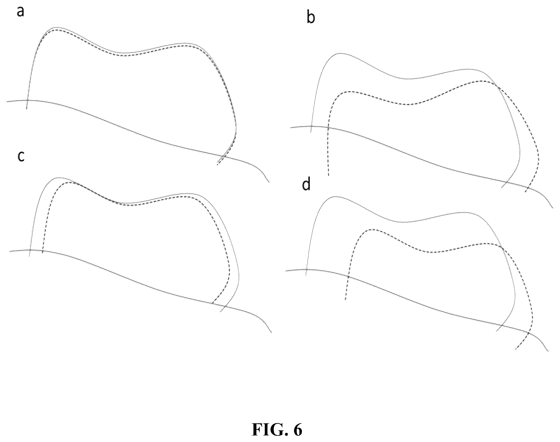 Patent US12551284 Figure 9 – Implant design optimization for geometric uncertainty