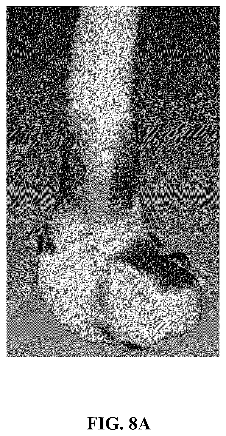 Patent US12551284 Figure 11 – Implant design optimization for geometric uncertainty