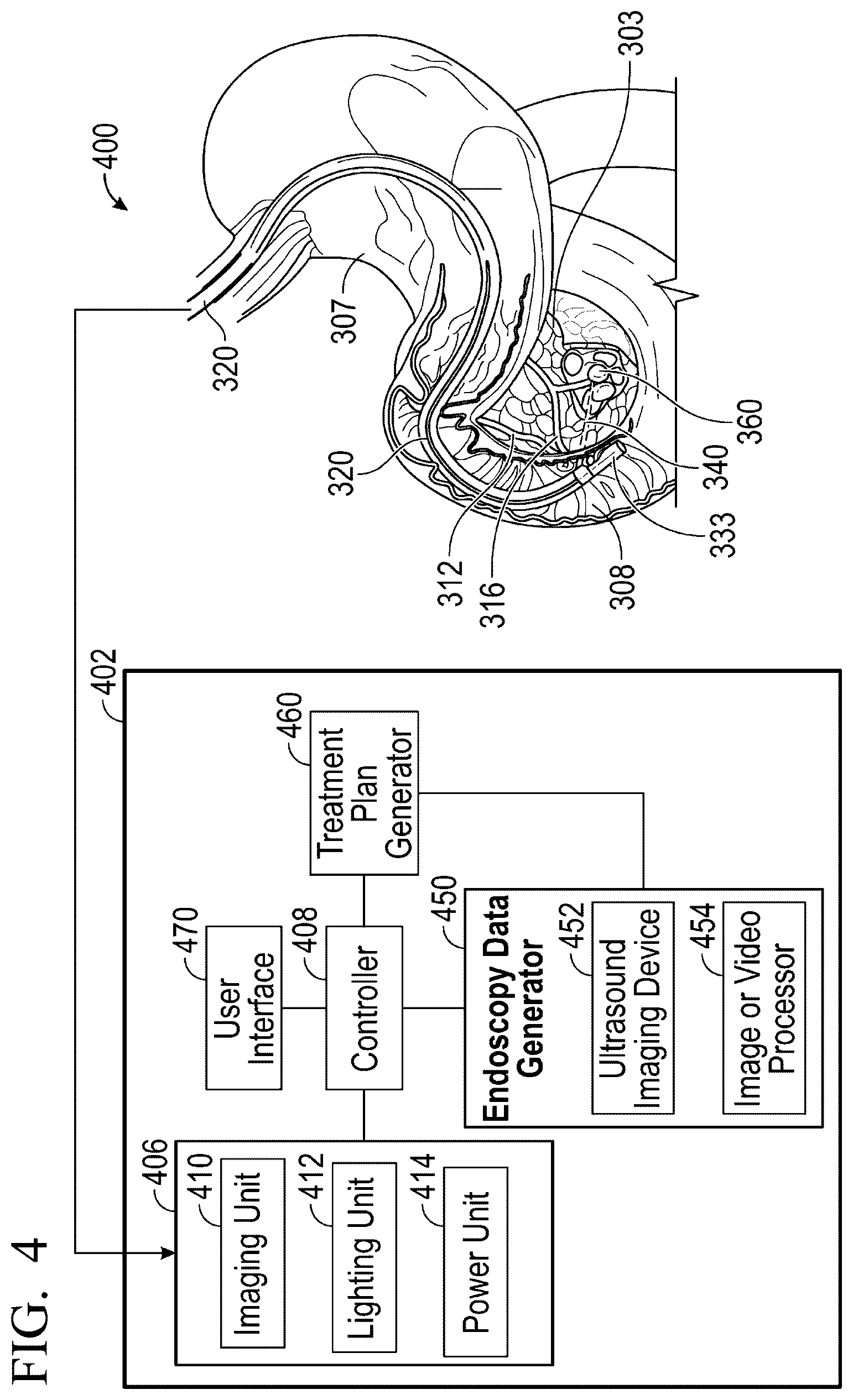 Patent US12551285 Figure 4 – Endoscopic ultrasound guided tissue acquisition