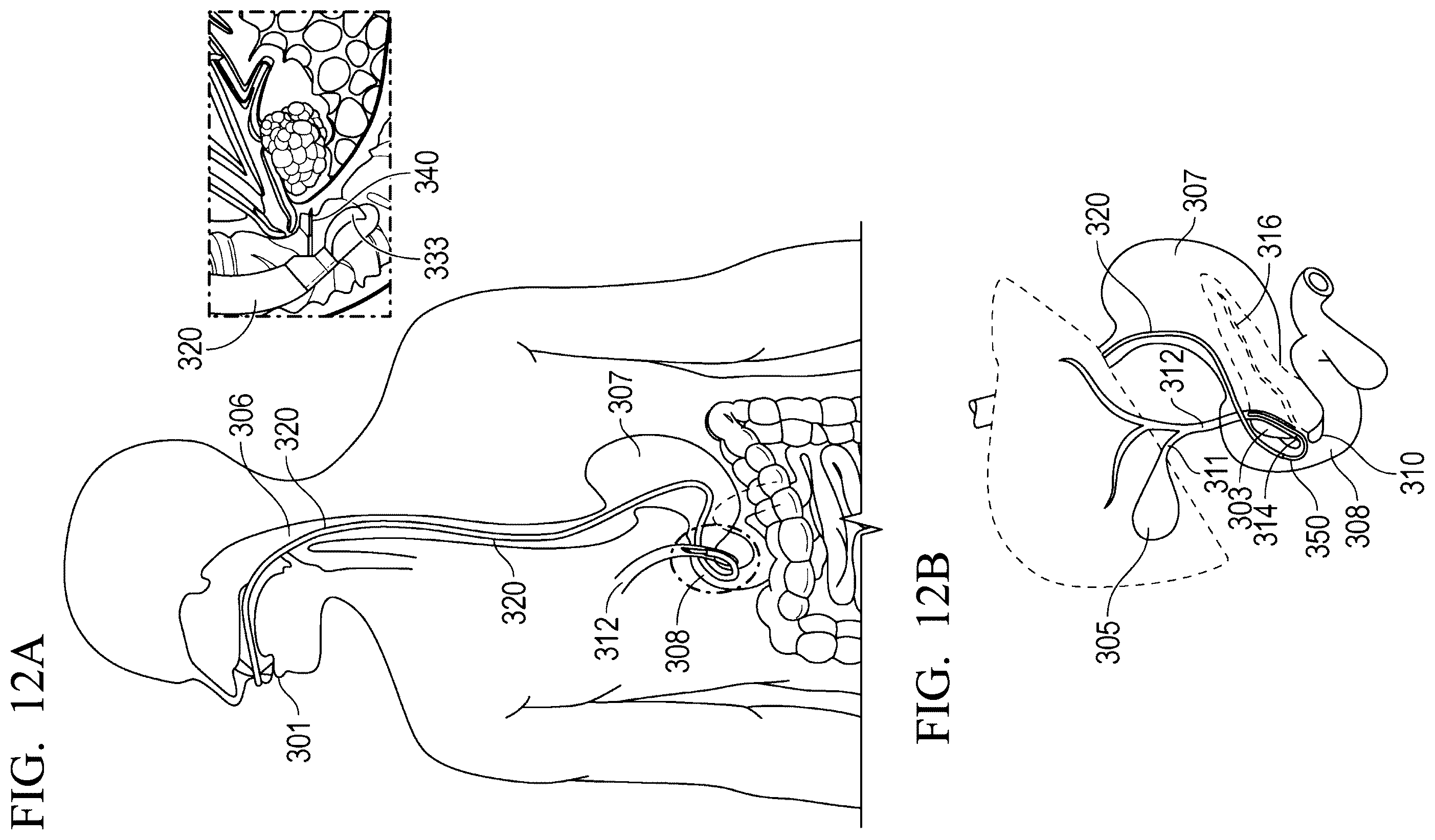 Patent US12551285 Figure 15 – Endoscopic ultrasound guided tissue acquisition