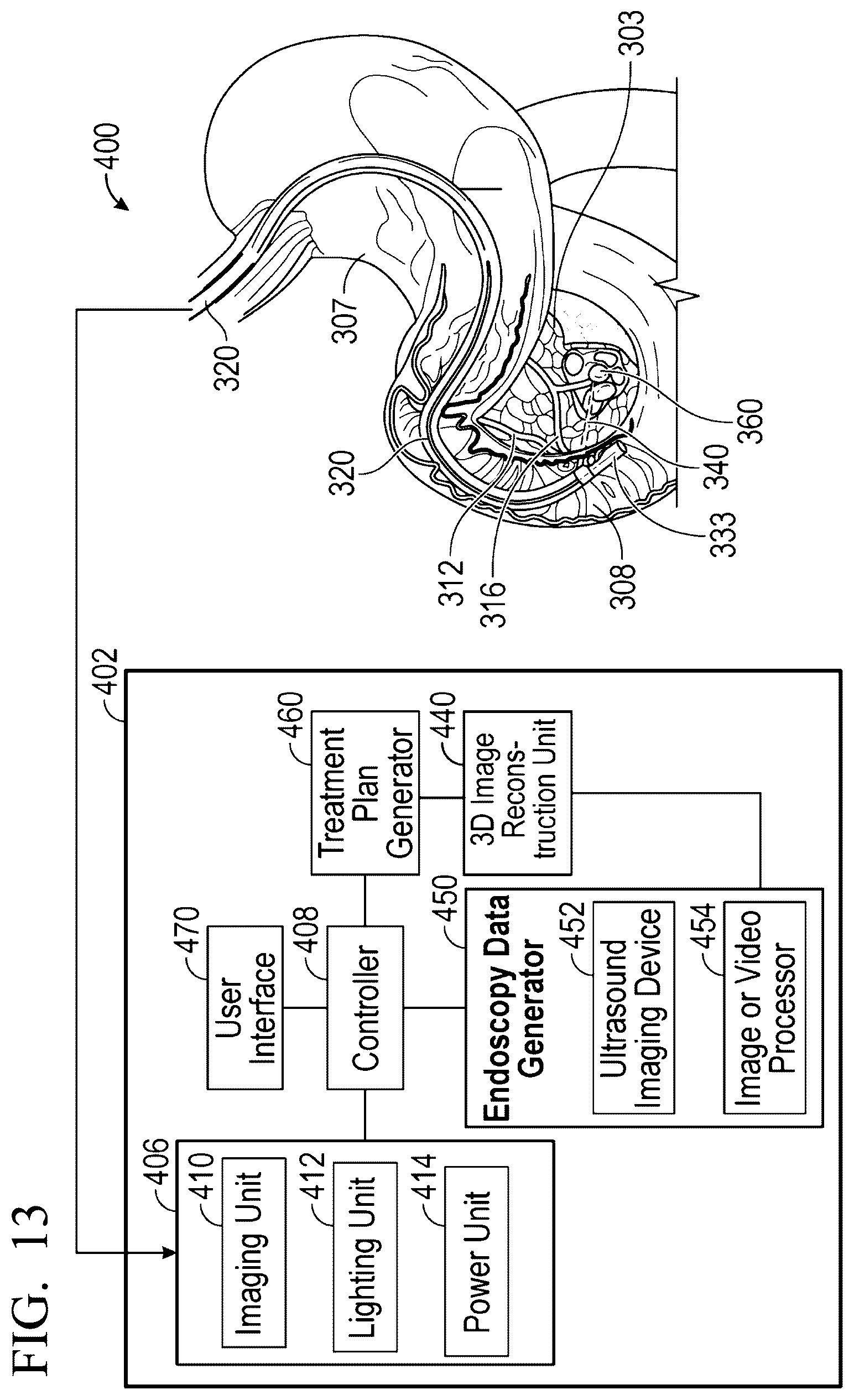 Patent US12551285 Figure 16 – Endoscopic ultrasound guided tissue acquisition