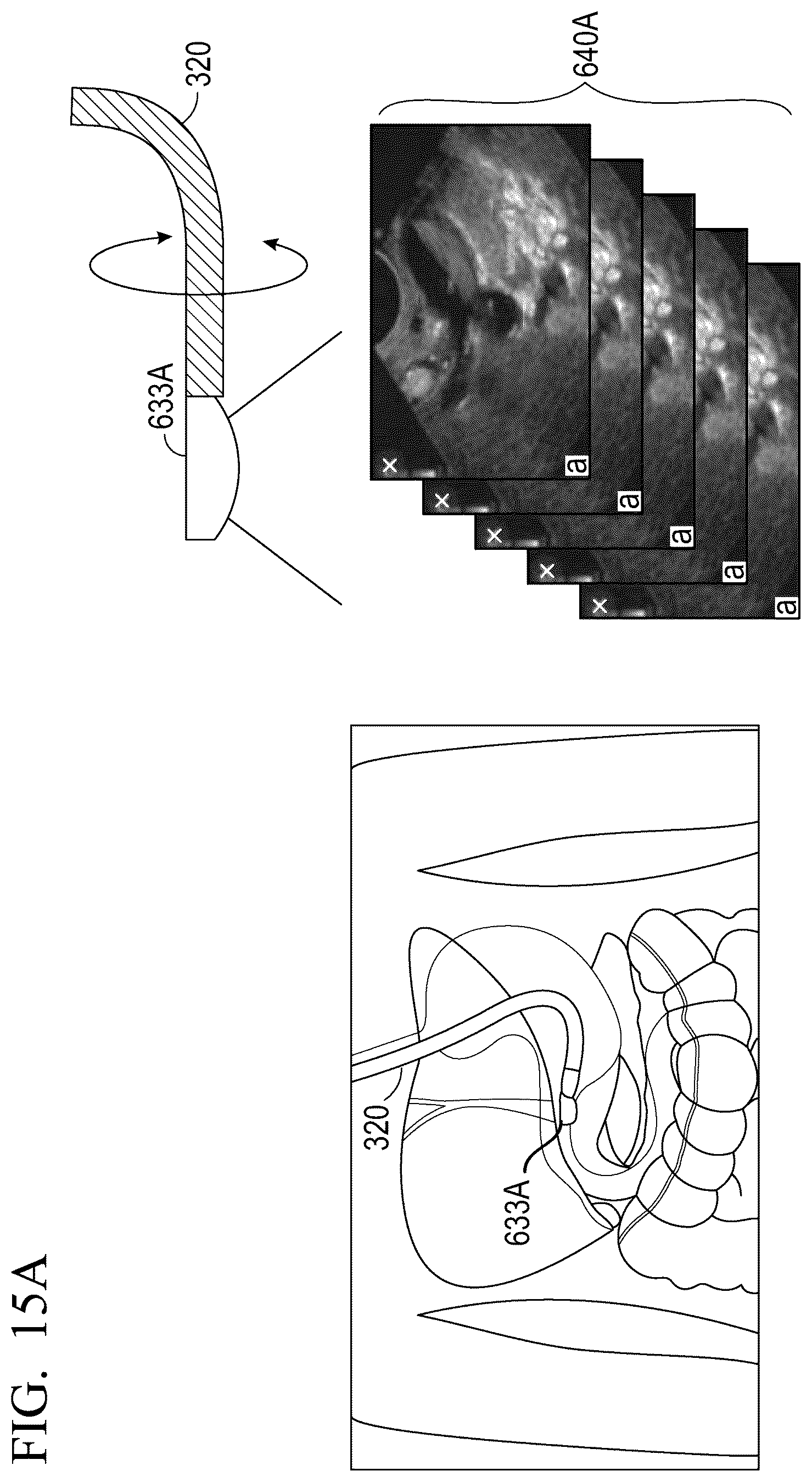 Patent US12551285 Figure 18 – Endoscopic ultrasound guided tissue acquisition