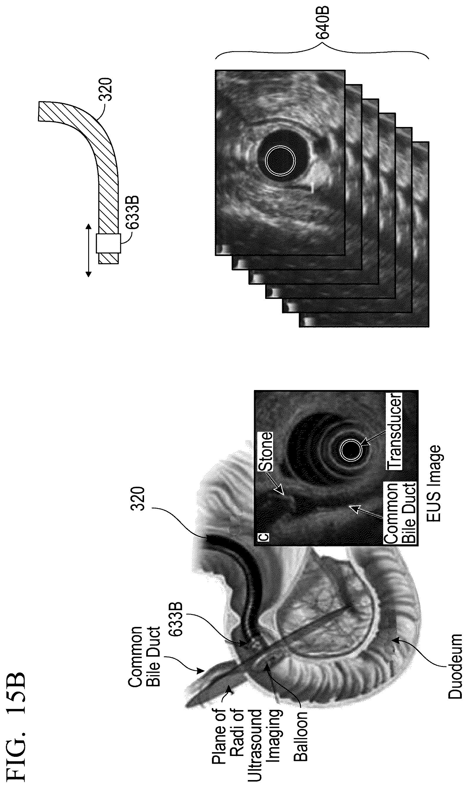 Patent US12551285 Figure 19 – Endoscopic ultrasound guided tissue acquisition