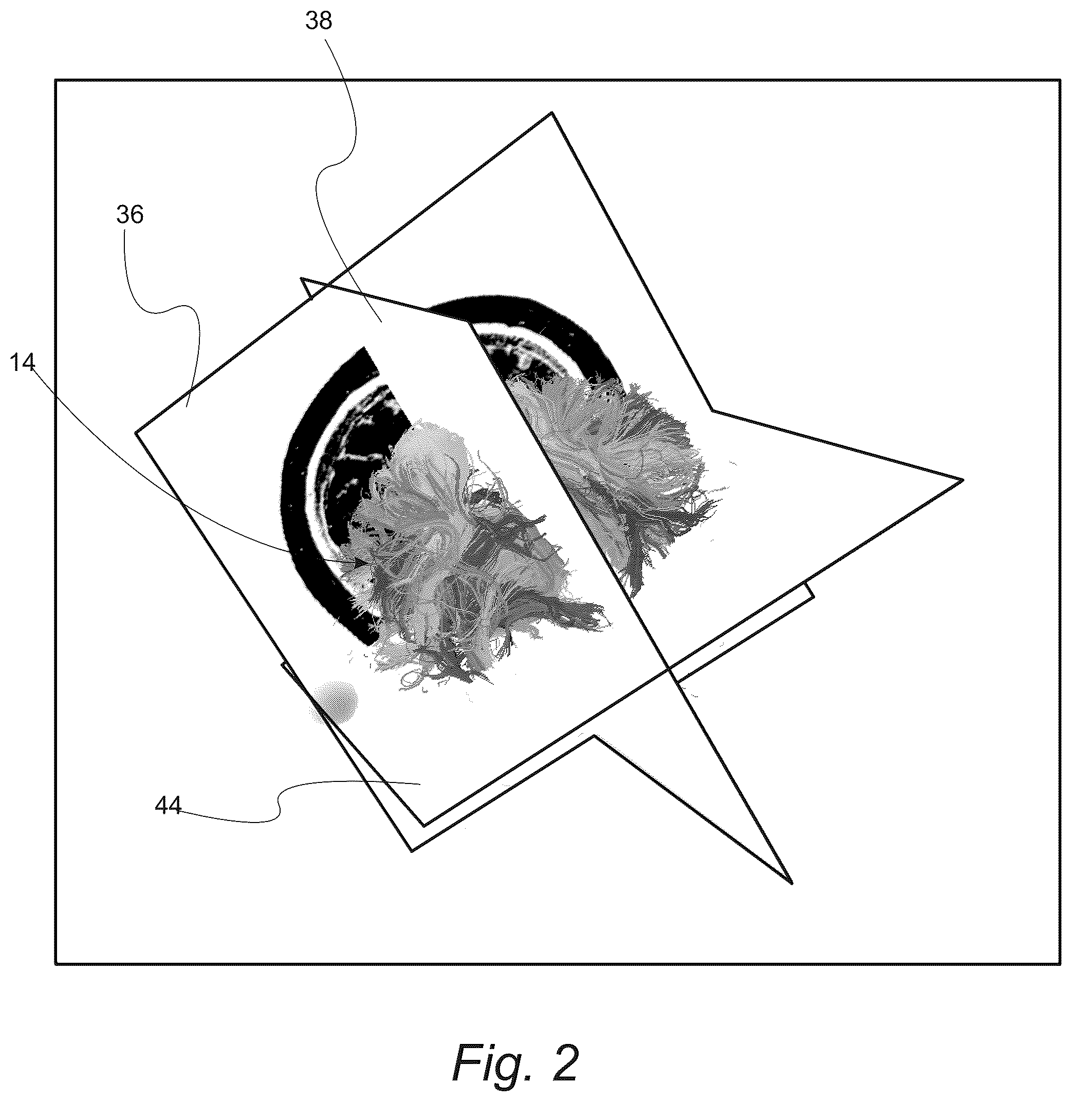 Patent US12551286 Figure 2 – Surgical planning, surgical navigation and imaging system