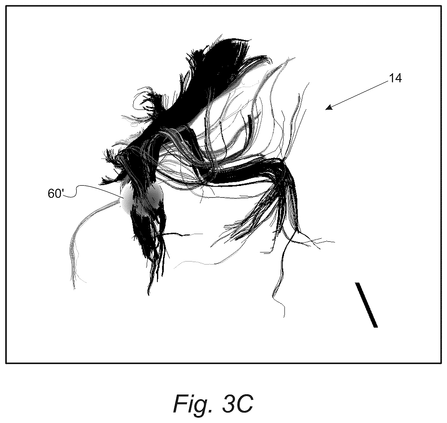 Patent US12551286 Figure 4 – Surgical planning, surgical navigation and imaging system