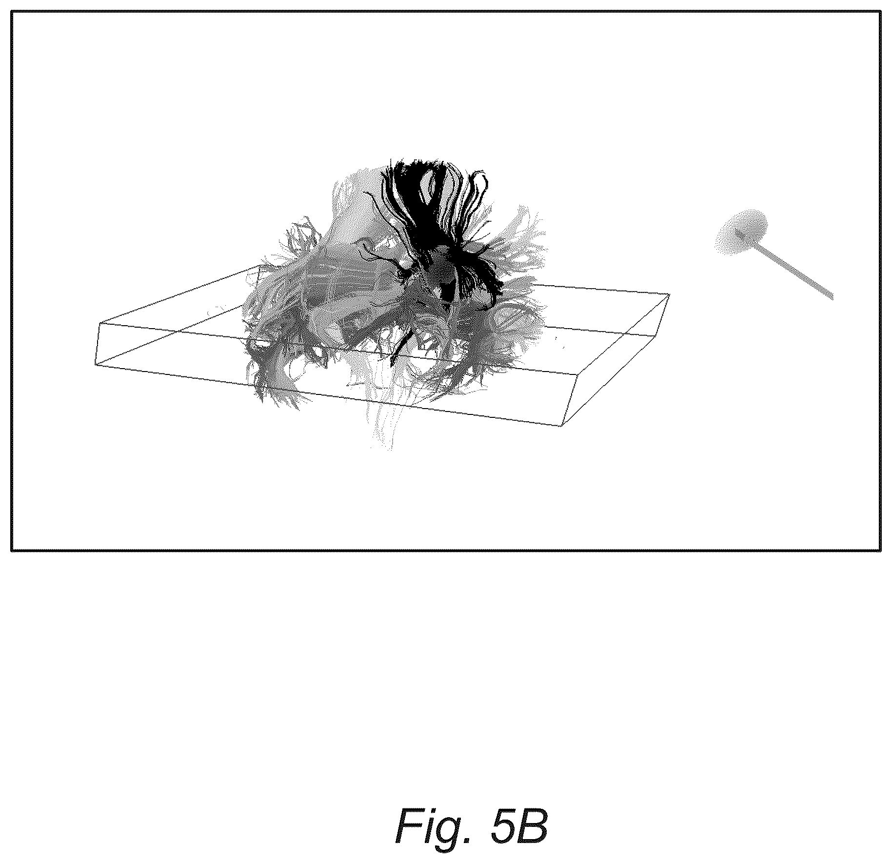 Patent US12551286 Figure 7 – Surgical planning, surgical navigation and imaging system