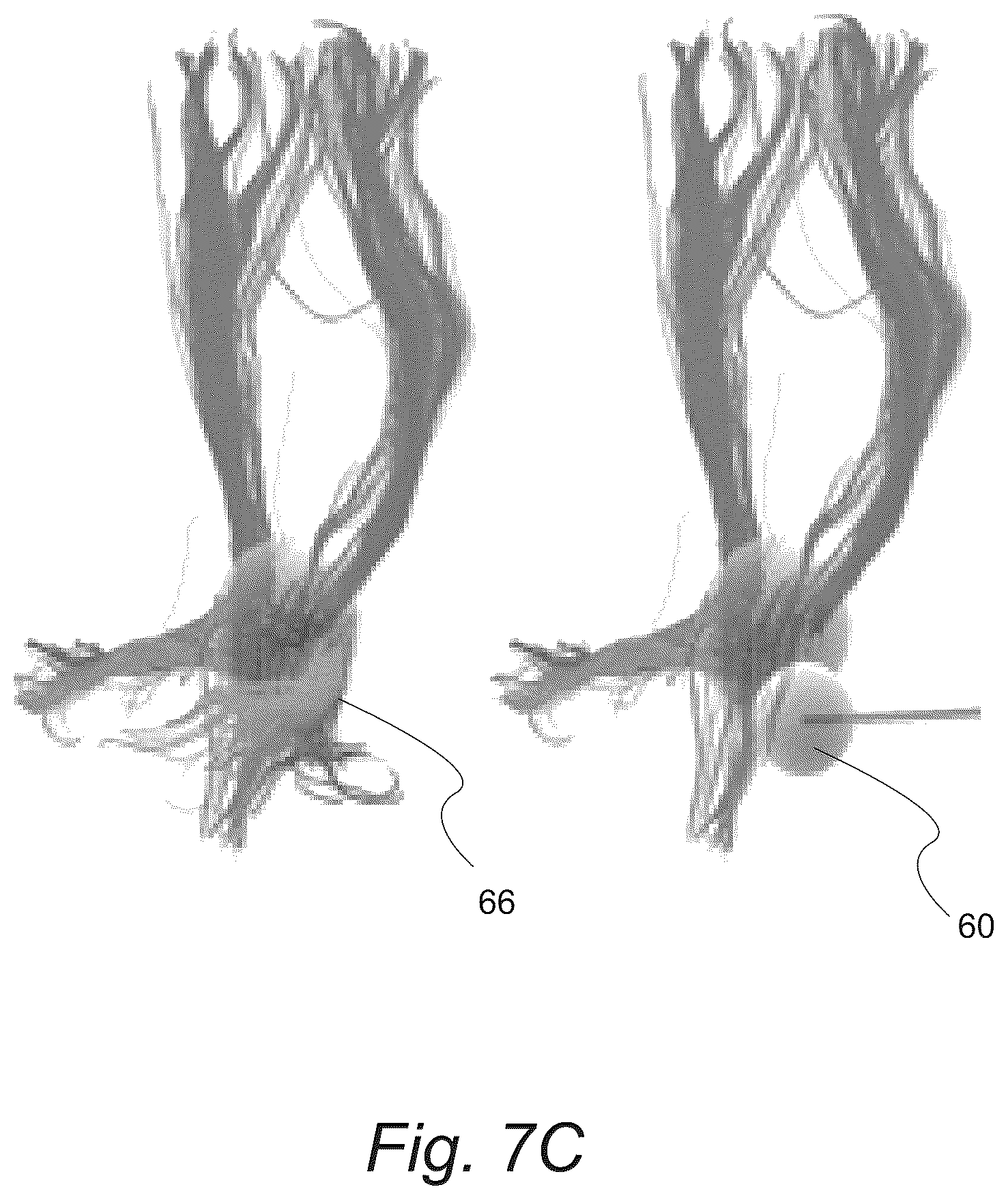 Patent US12551286 Figure 12 – Surgical planning, surgical navigation and imaging system