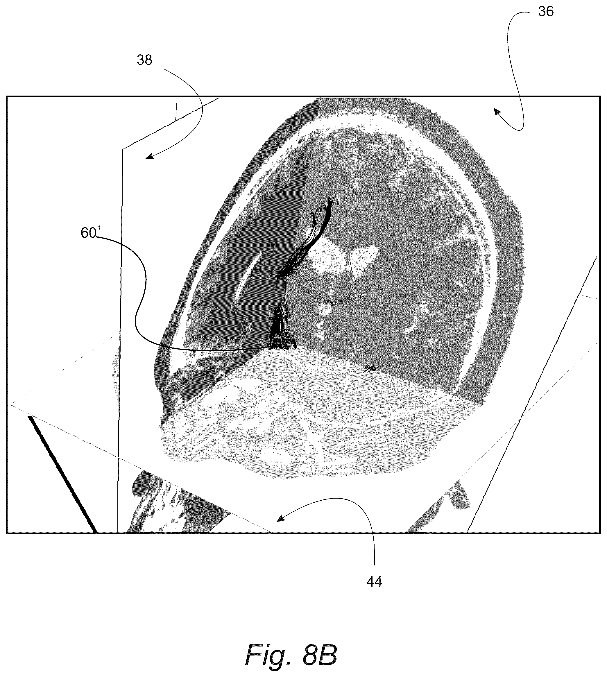 Patent US12551286 Figure 14 – Surgical planning, surgical navigation and imaging system