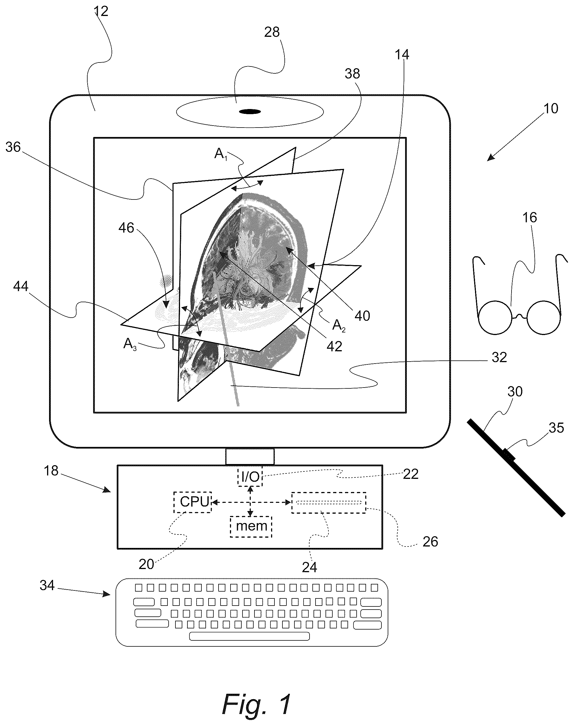 Patent US12551287 Figure 1 – Surgical planning, surgical navigation and imaging system