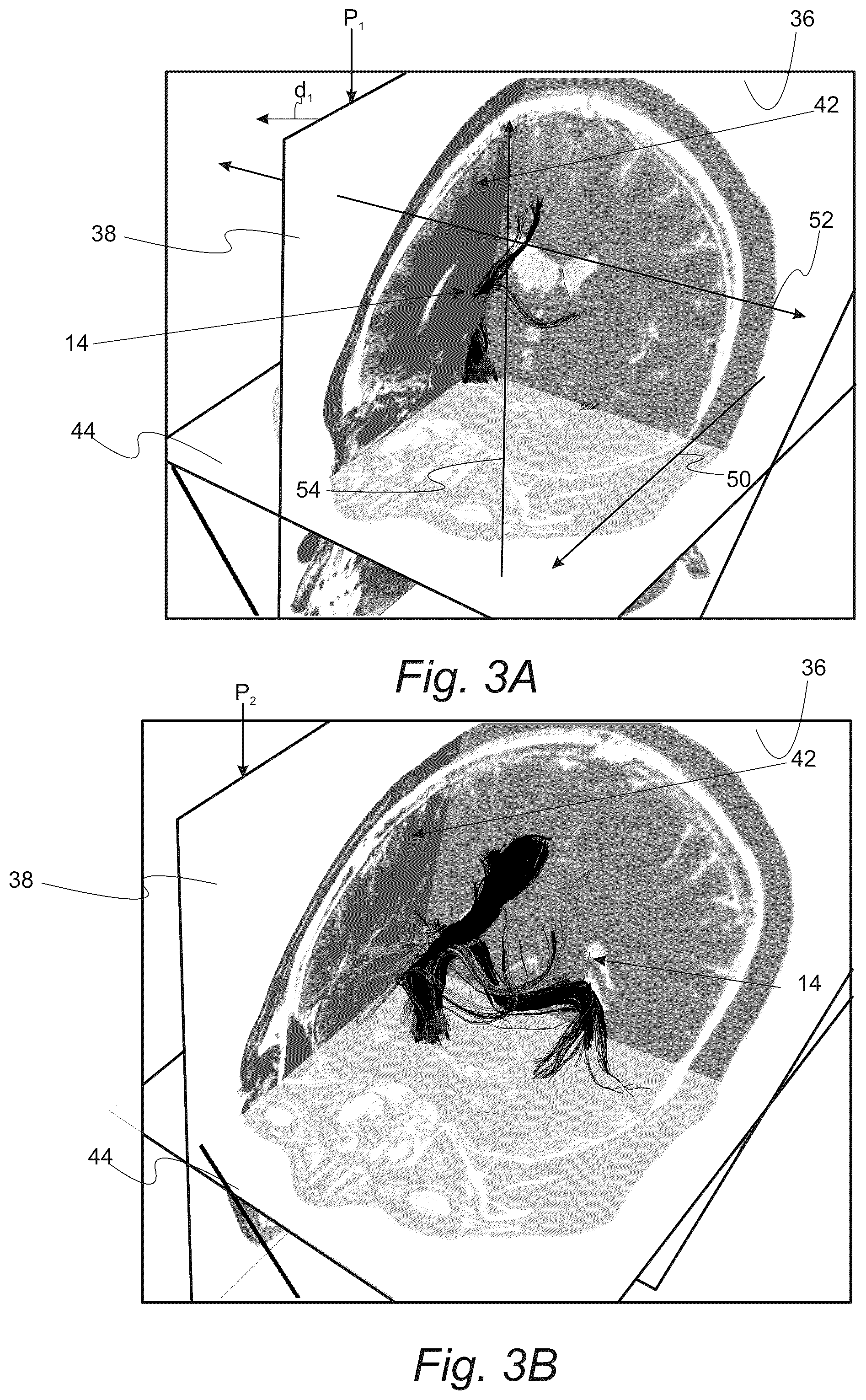 Patent US12551287 Figure 3 – Surgical planning, surgical navigation and imaging system