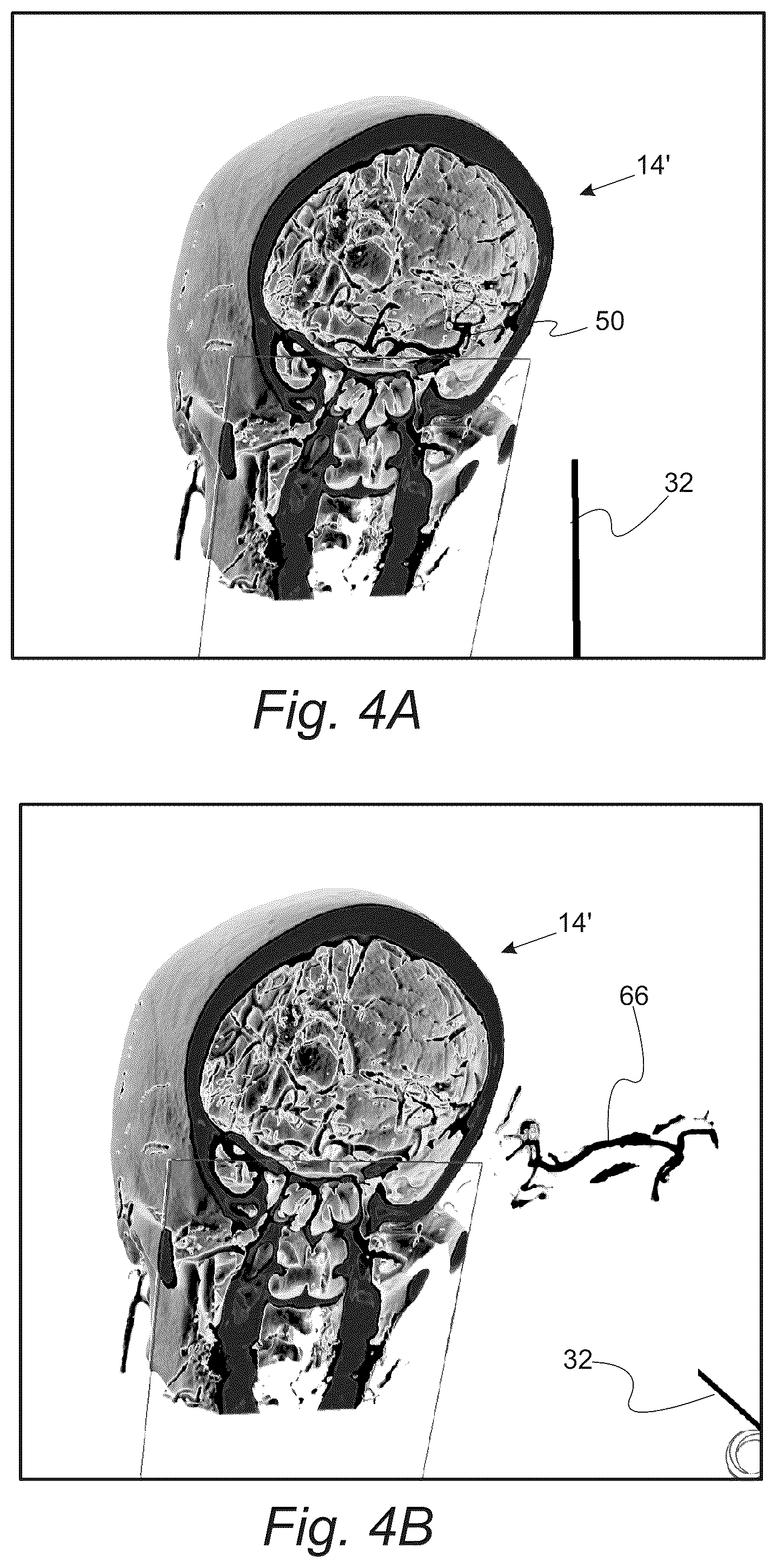 Patent US12551287 Figure 5 – Surgical planning, surgical navigation and imaging system