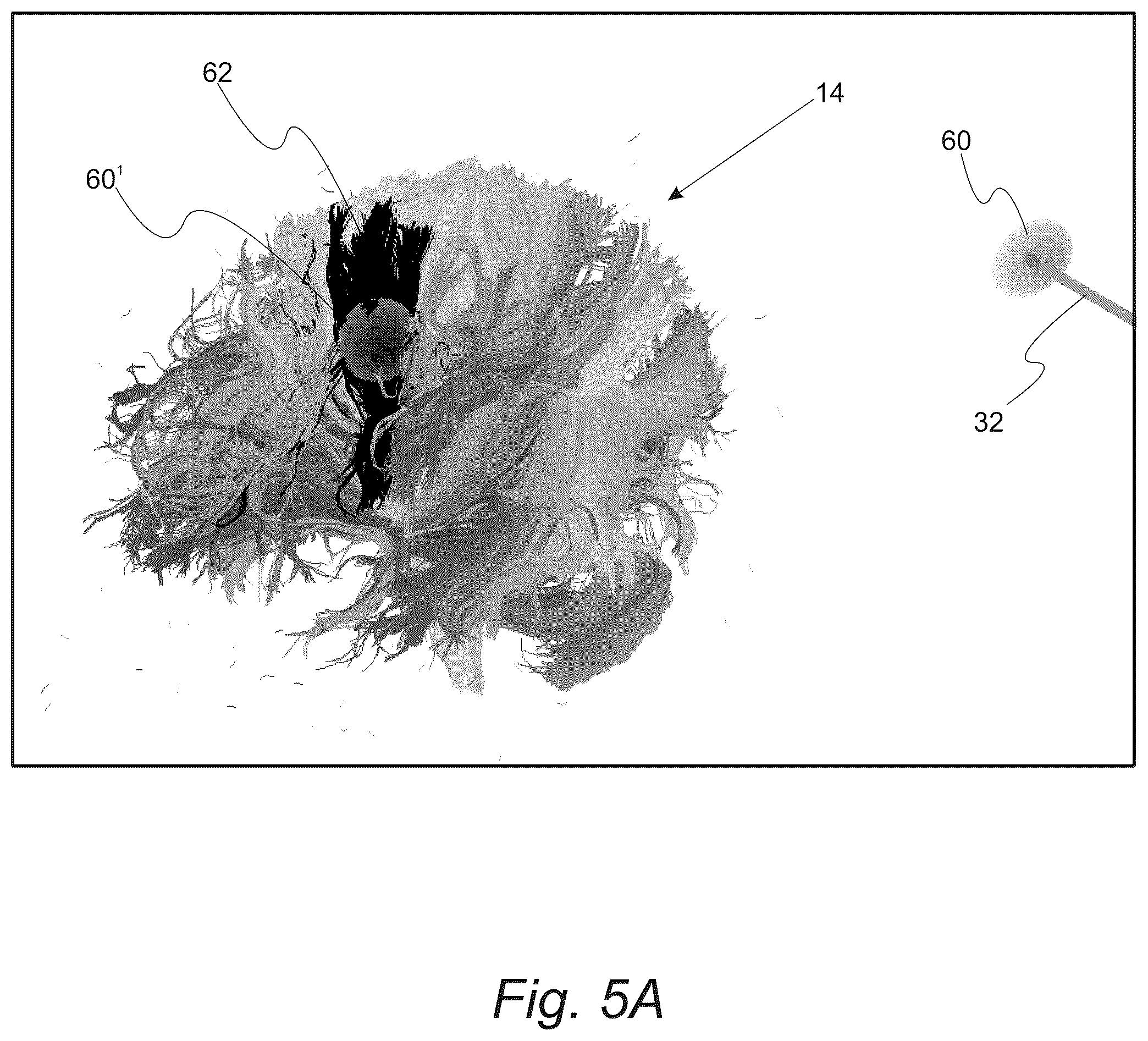 Patent US12551287 Figure 6 – Surgical planning, surgical navigation and imaging system