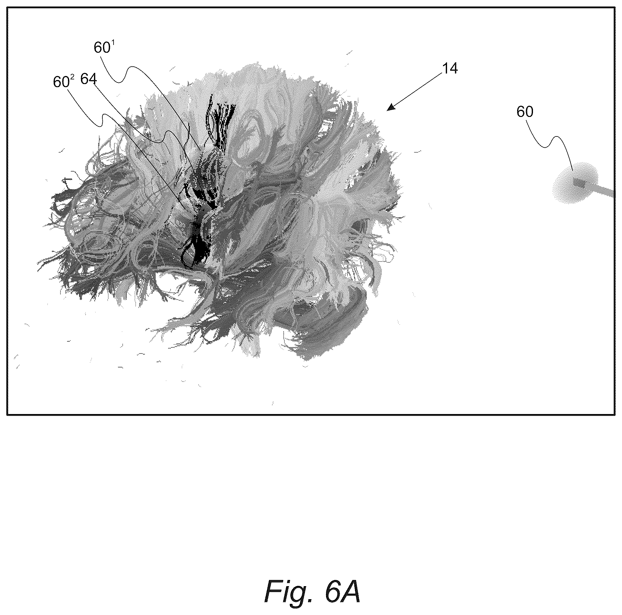 Patent US12551287 Figure 8 – Surgical planning, surgical navigation and imaging system