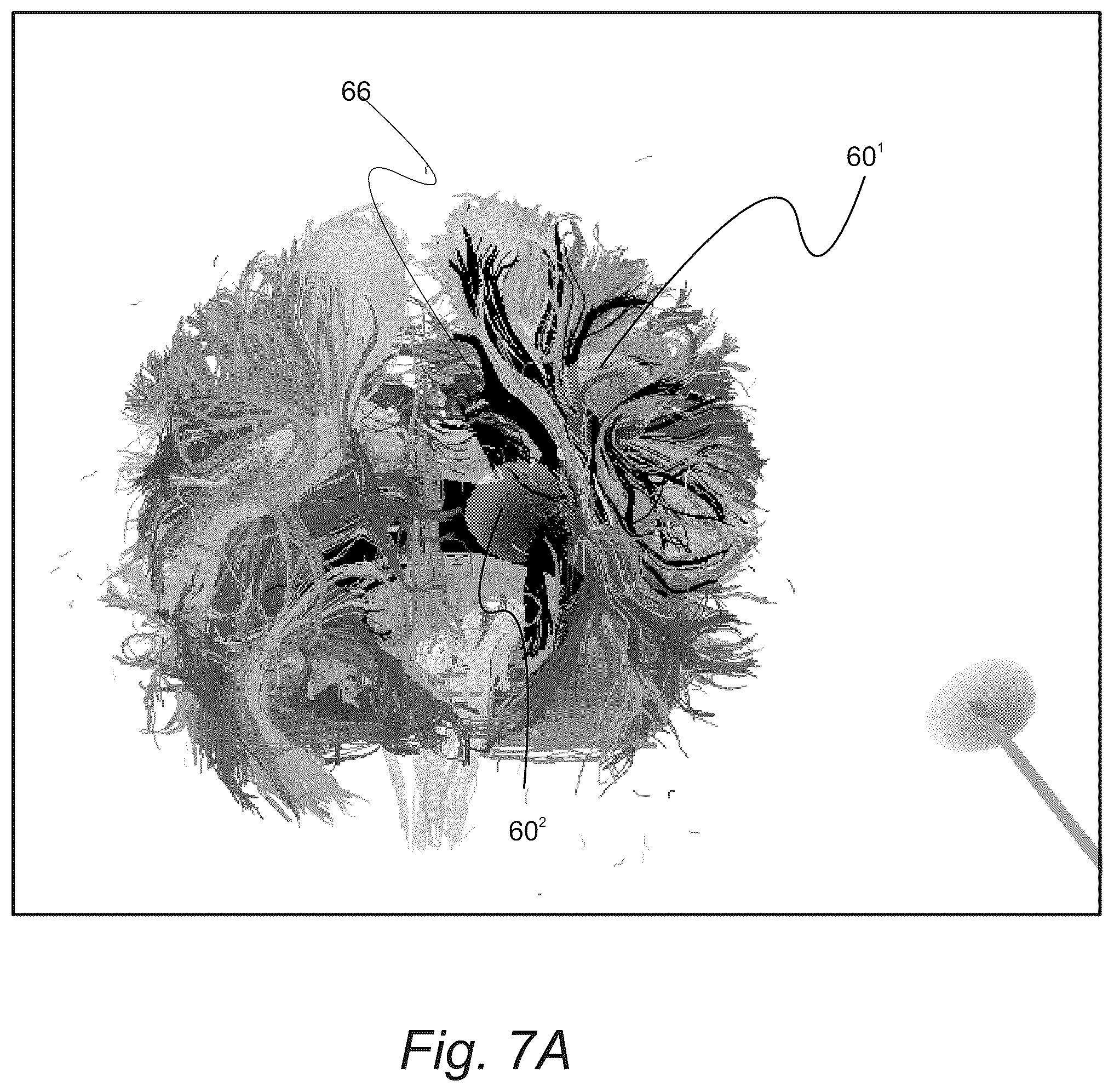 Patent US12551287 Figure 10 – Surgical planning, surgical navigation and imaging system
