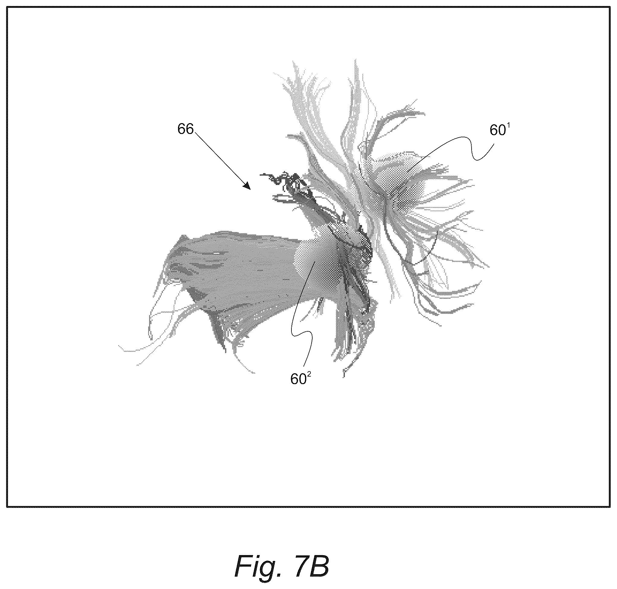Patent US12551287 Figure 11 – Surgical planning, surgical navigation and imaging system