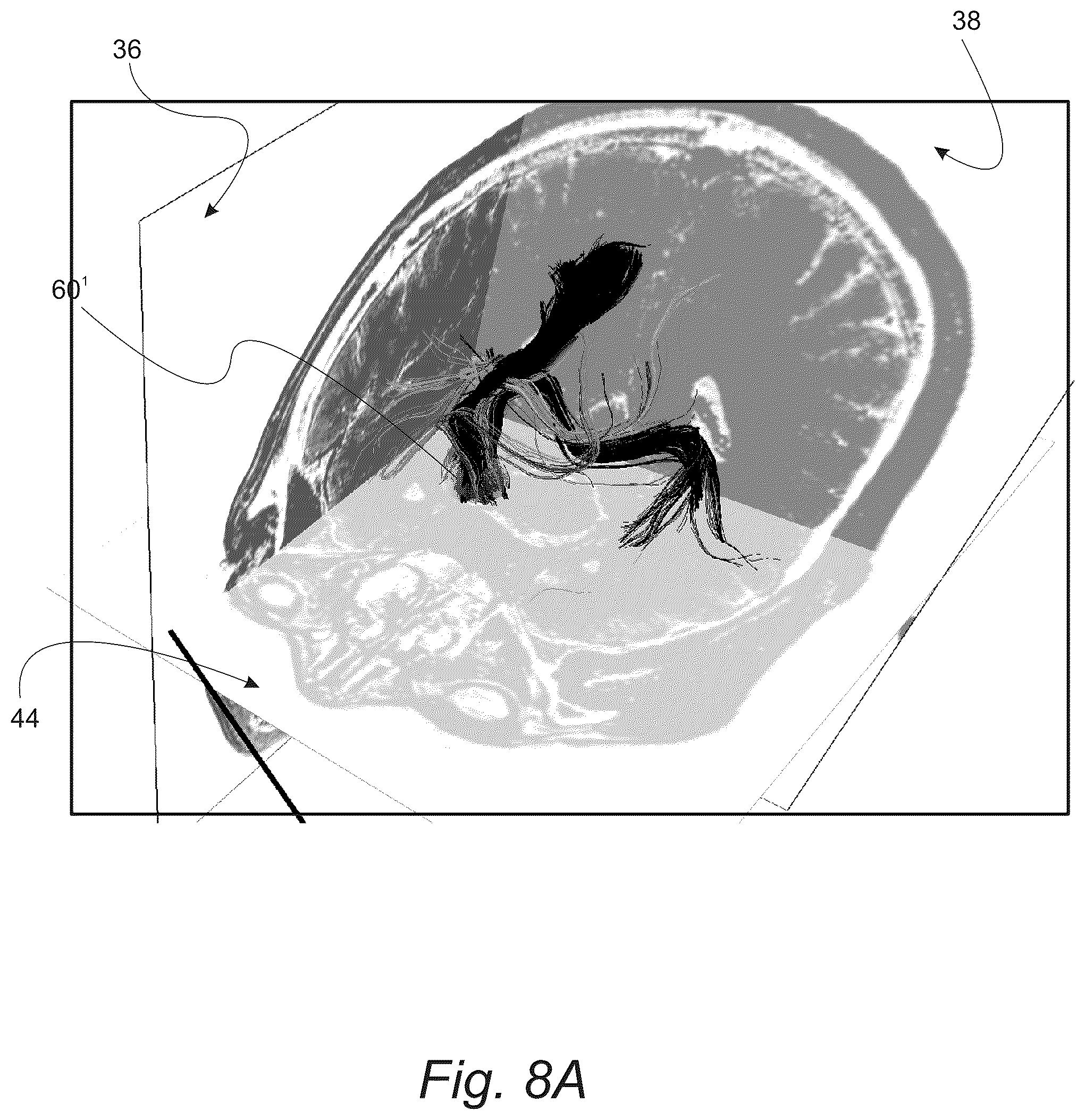 Patent US12551287 Figure 13 – Surgical planning, surgical navigation and imaging system