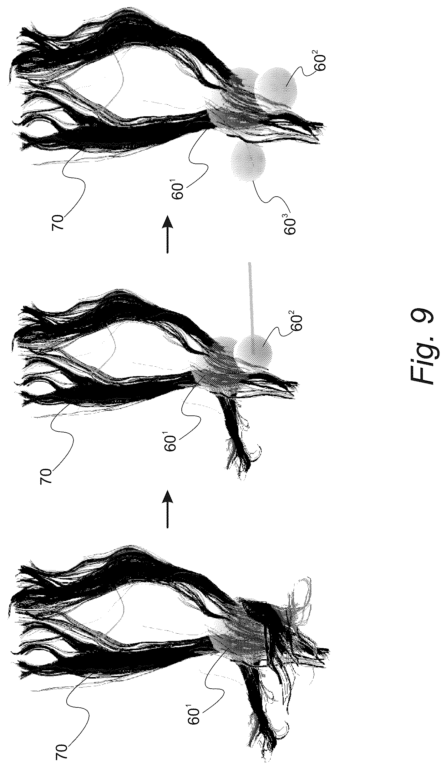 Patent US12551287 Figure 15 – Surgical planning, surgical navigation and imaging system