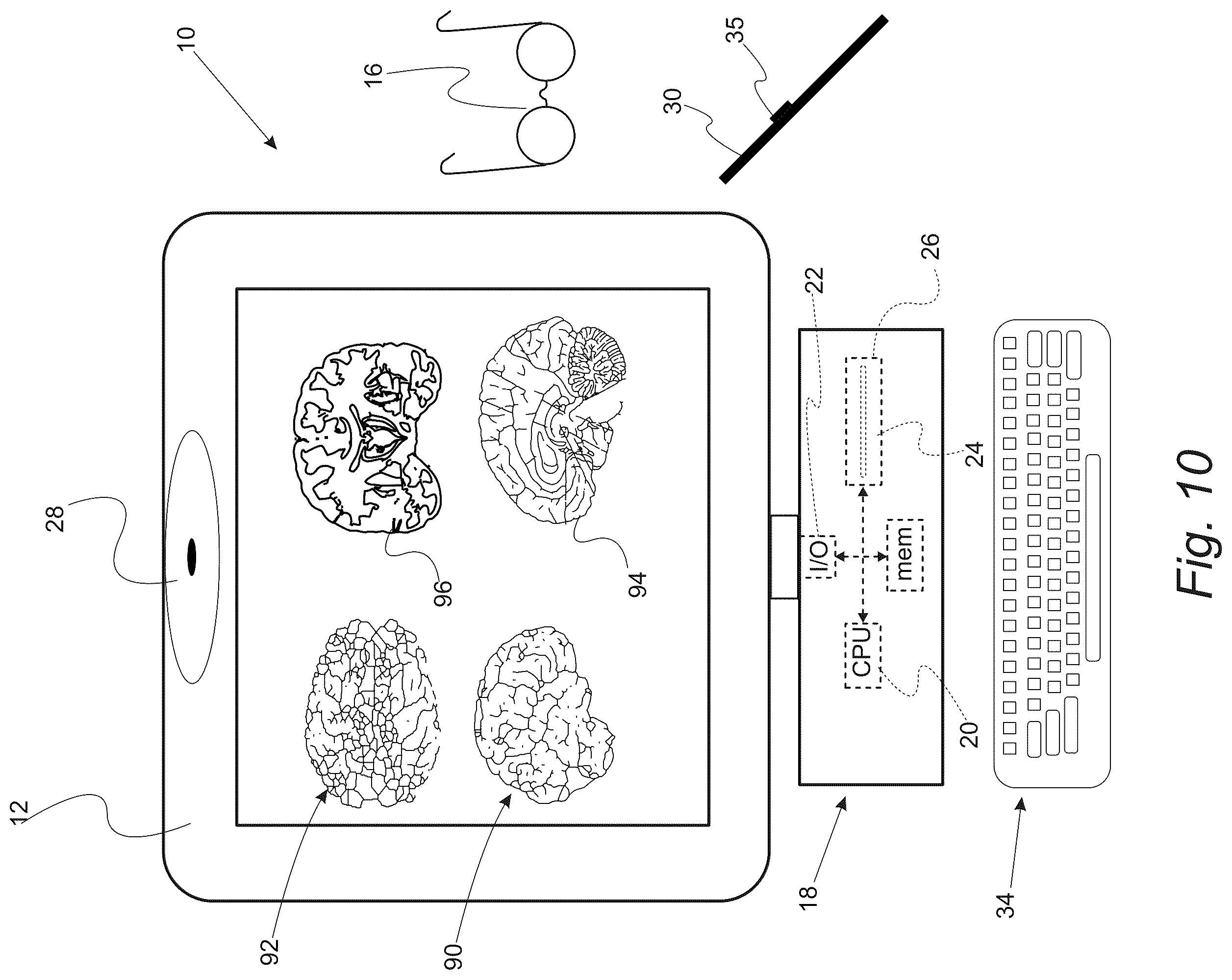 Patent US12551287 Figure 16 – Surgical planning, surgical navigation and imaging system