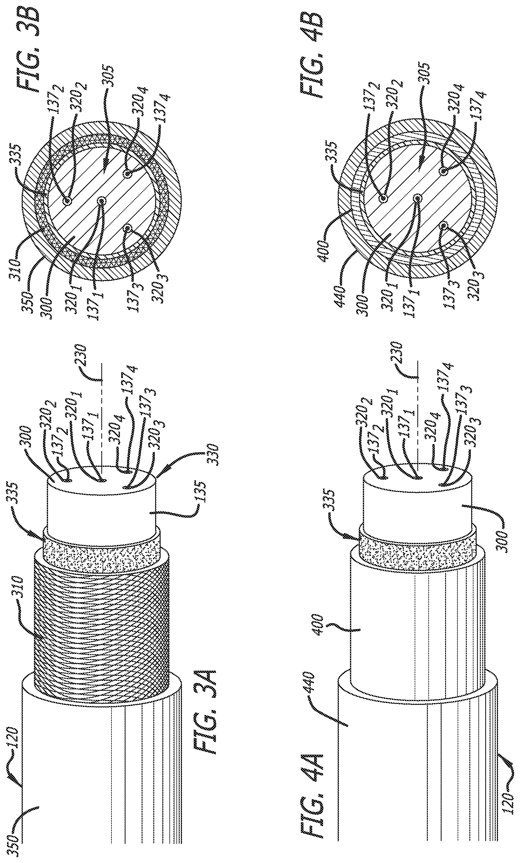 Patent US12551288 Figure 4 – Fiber optic enabled deployable medical devices for monitoring, assessment and capture of deployment information