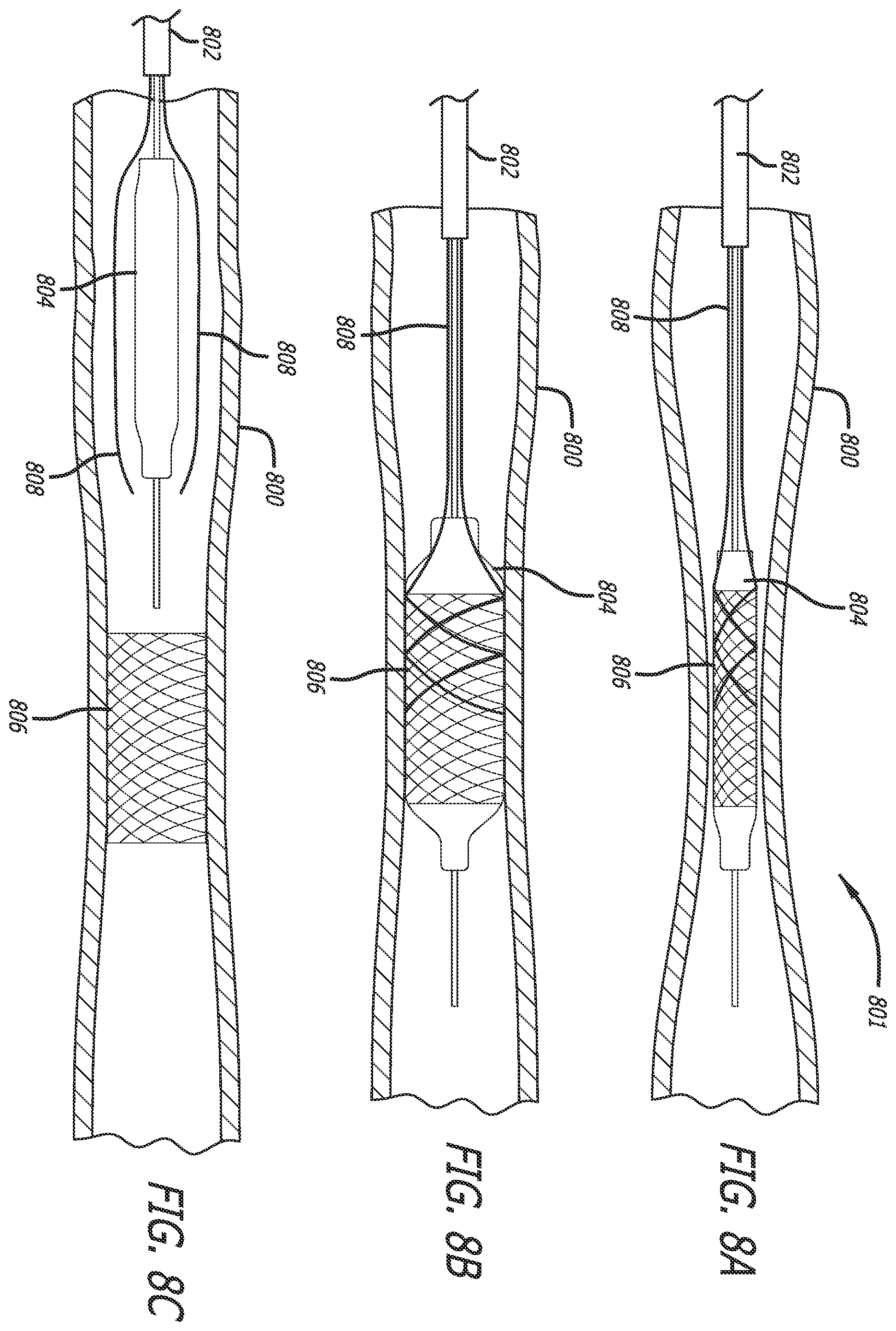 Patent US12551288 Figure 9 – Fiber optic enabled deployable medical devices for monitoring, assessment and capture of deployment information