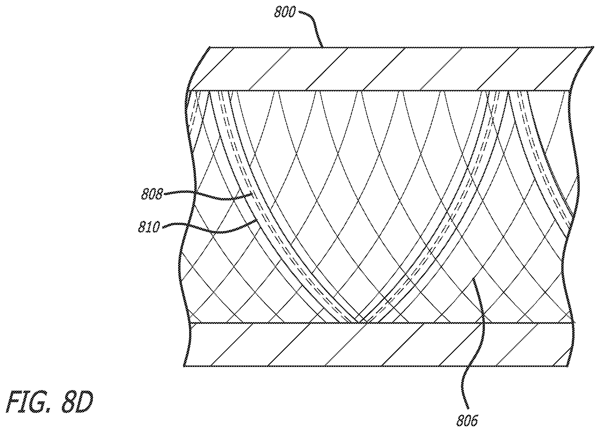 Patent US12551288 Figure 10 – Fiber optic enabled deployable medical devices for monitoring, assessment and capture of deployment information