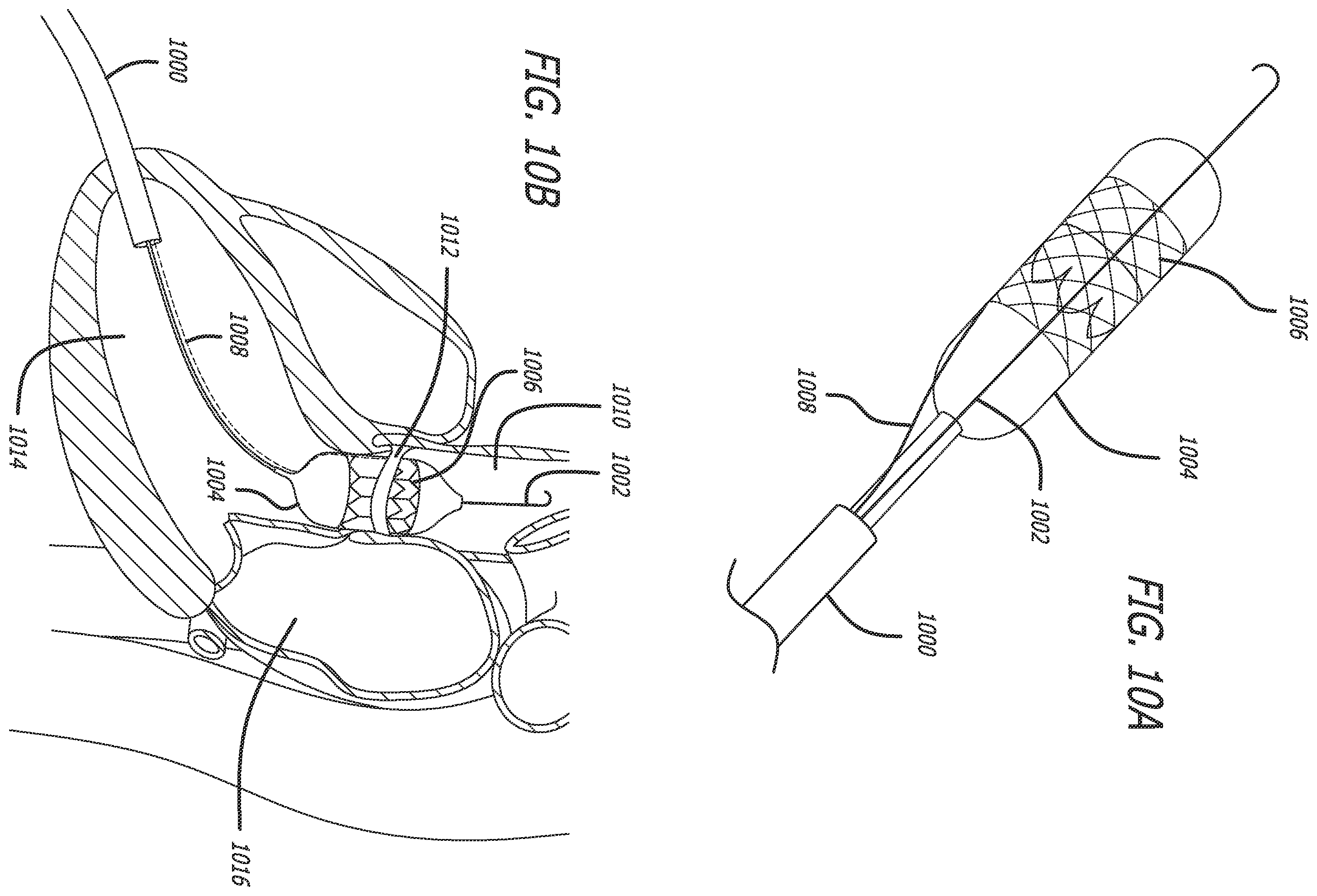 Patent US12551288 Figure 12 – Fiber optic enabled deployable medical devices for monitoring, assessment and capture of deployment information
