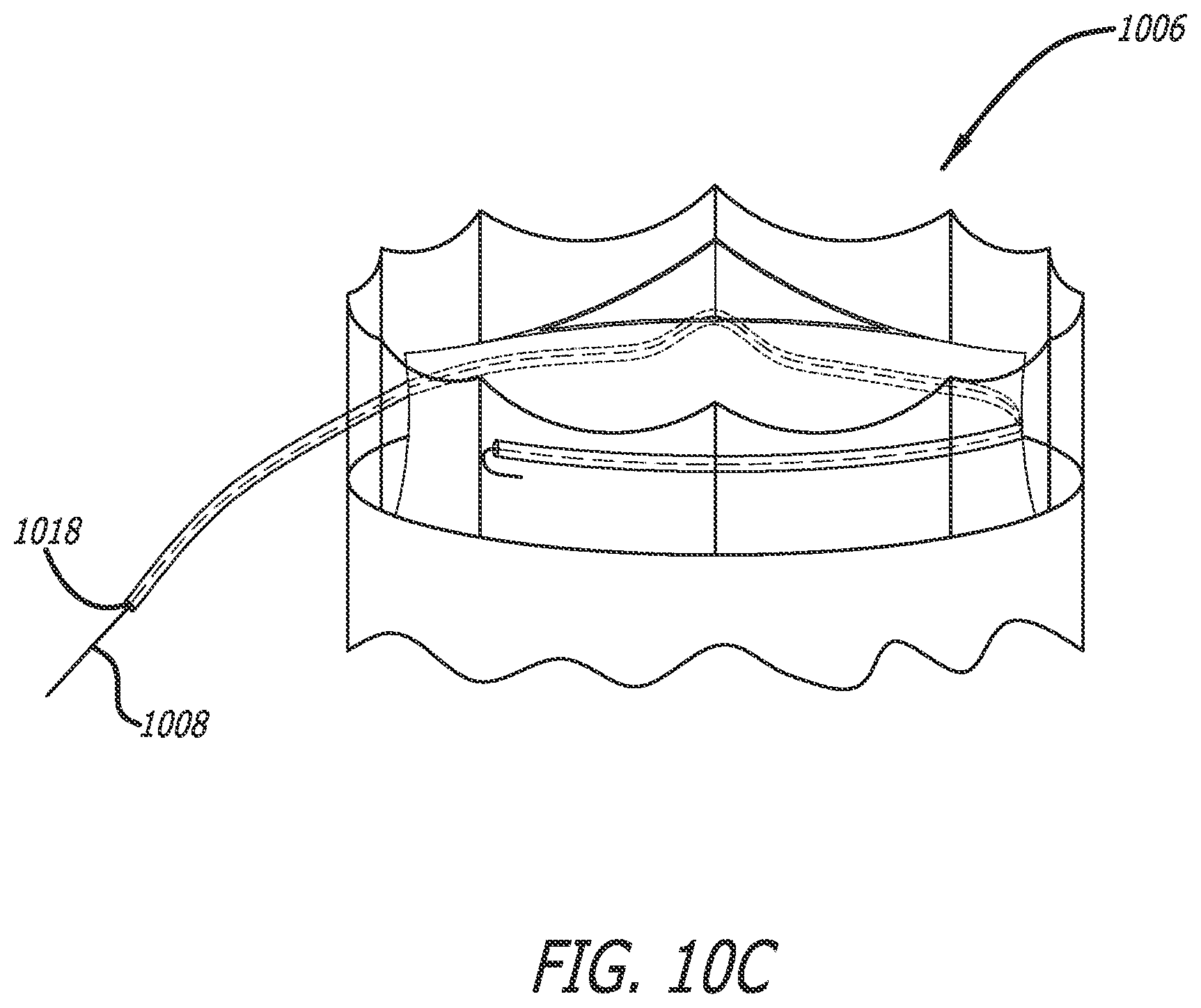 Patent US12551288 Figure 13 – Fiber optic enabled deployable medical devices for monitoring, assessment and capture of deployment information