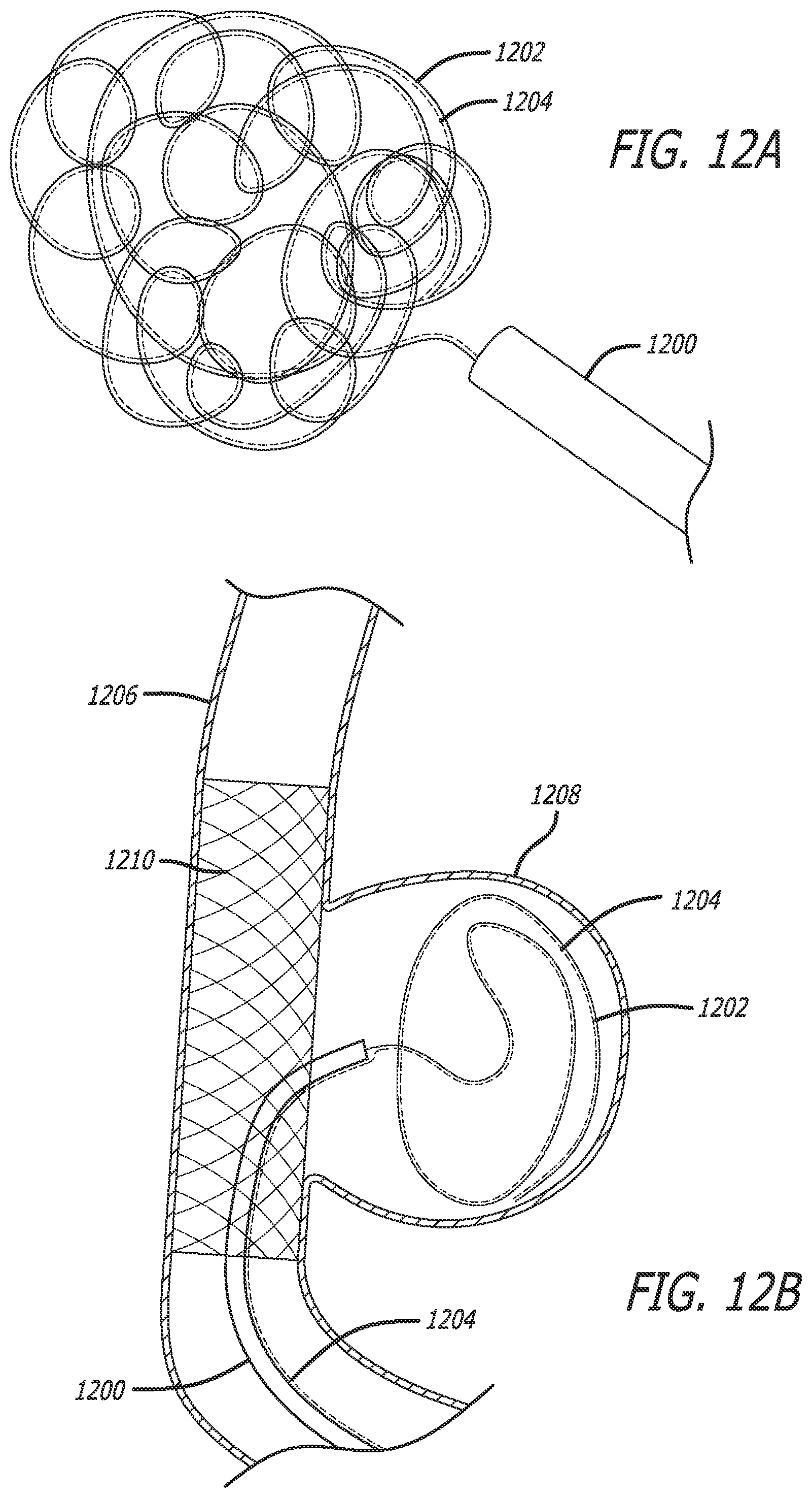 Patent US12551288 Figure 15 – Fiber optic enabled deployable medical devices for monitoring, assessment and capture of deployment information
