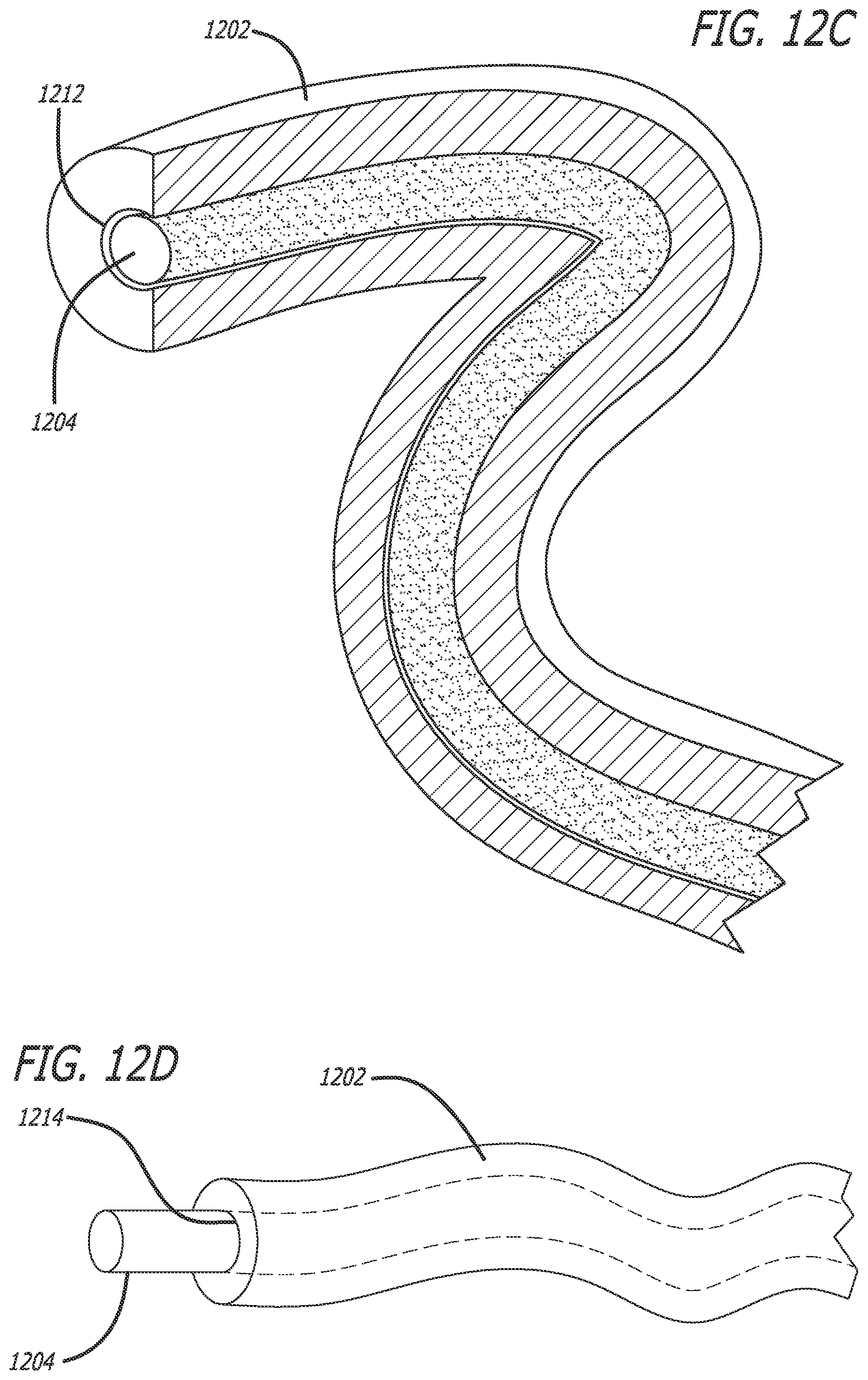 Patent US12551288 Figure 16 – Fiber optic enabled deployable medical devices for monitoring, assessment and capture of deployment information