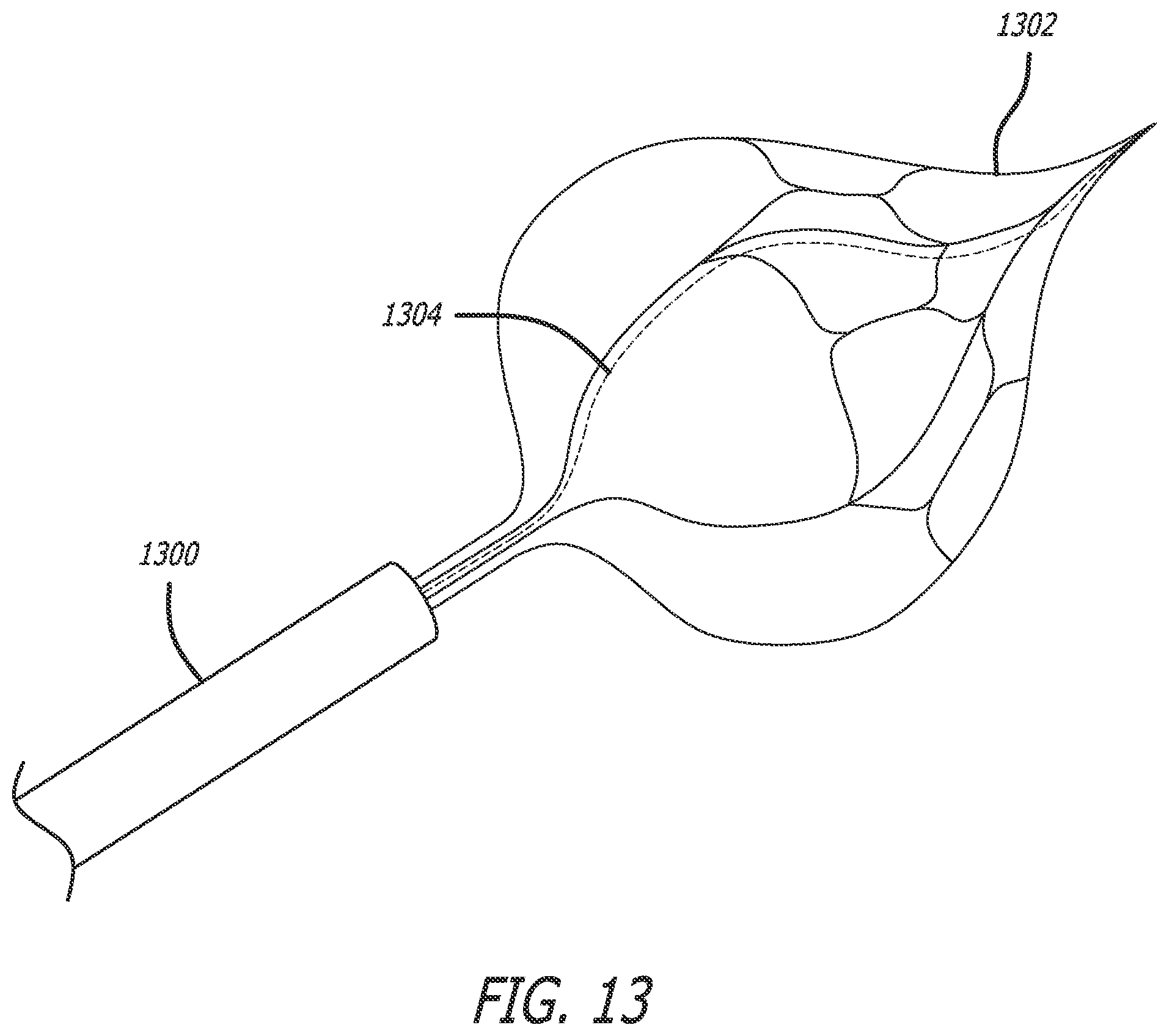 Patent US12551288 Figure 17 – Fiber optic enabled deployable medical devices for monitoring, assessment and capture of deployment information