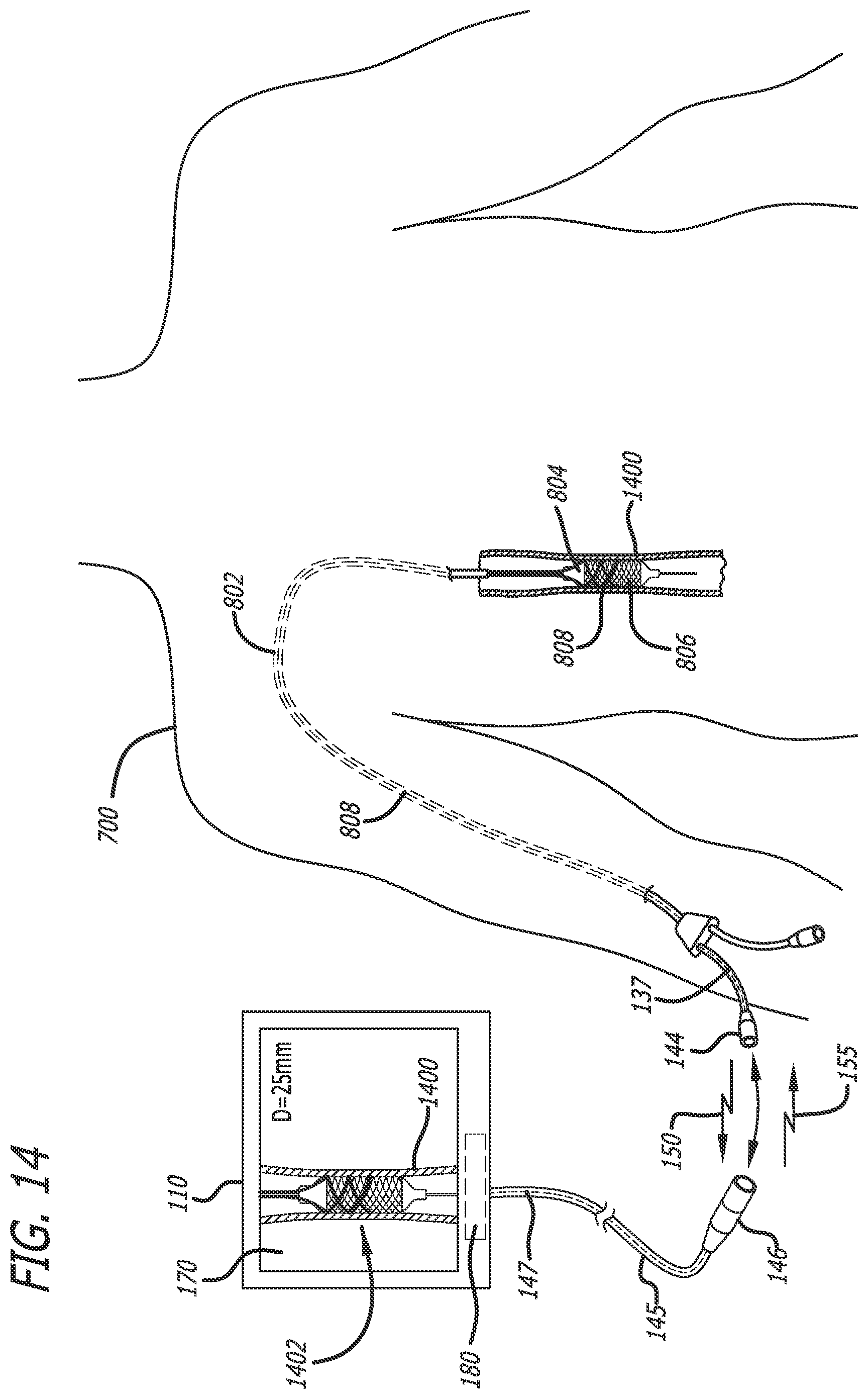 Patent US12551288 Figure 18 – Fiber optic enabled deployable medical devices for monitoring, assessment and capture of deployment information