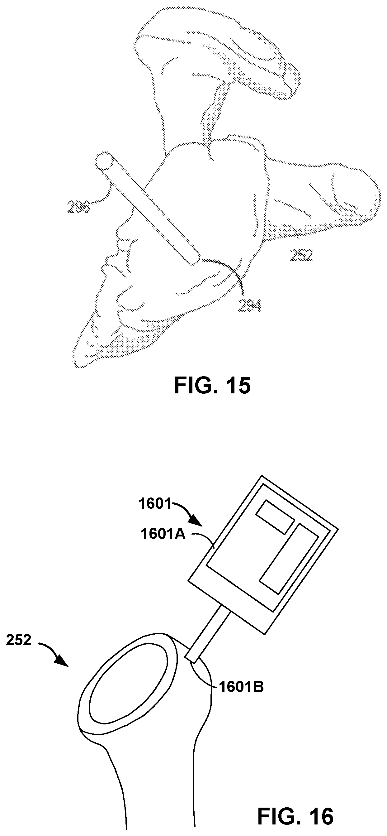 Patent US12551290 Figure 12 – Bone wall tracking and guidance for orthopedic implant placement