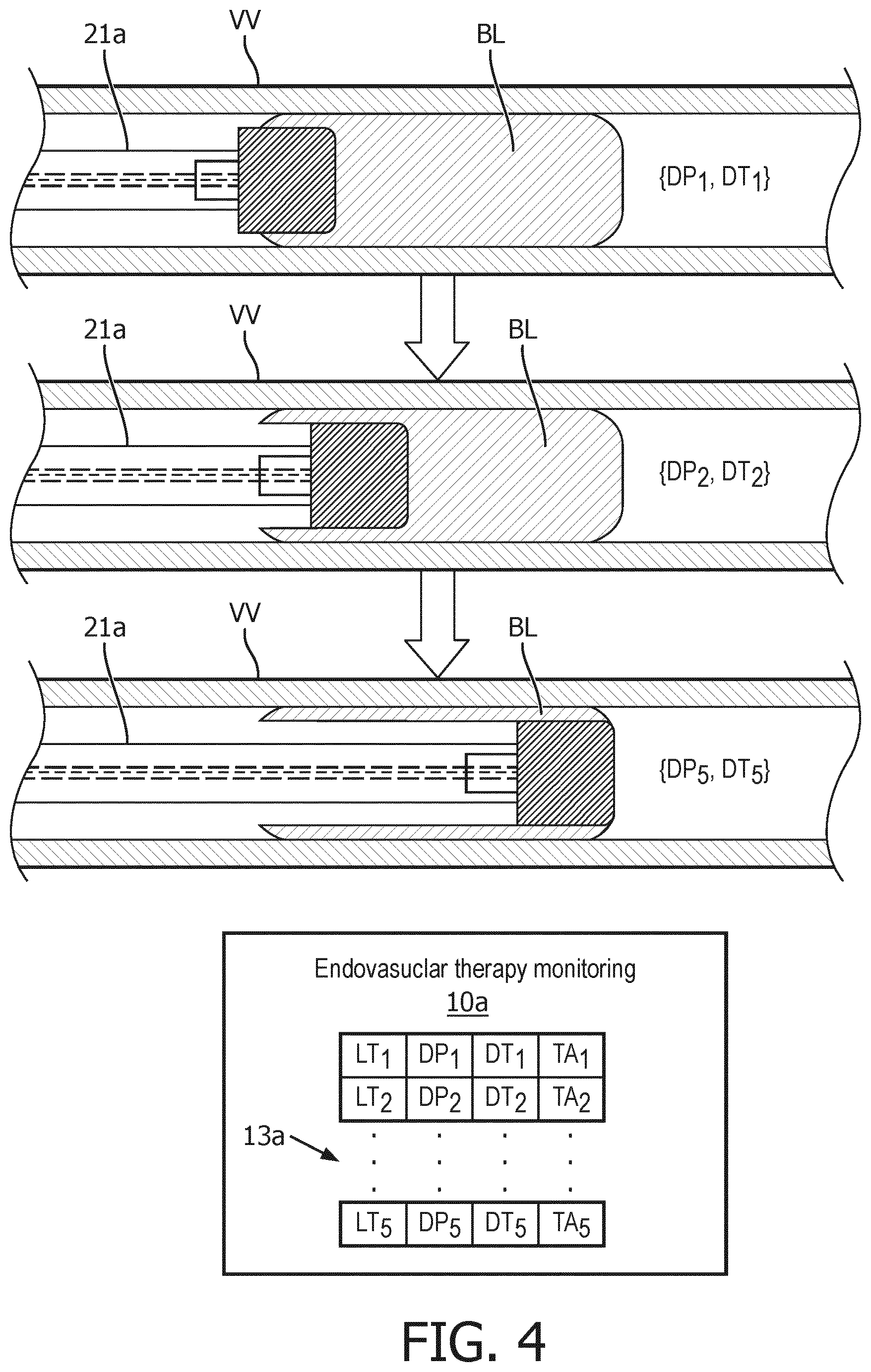 Patent US12551291 Figure 4 – Dwelling treatment monitoring for endoluminal therapy procedures