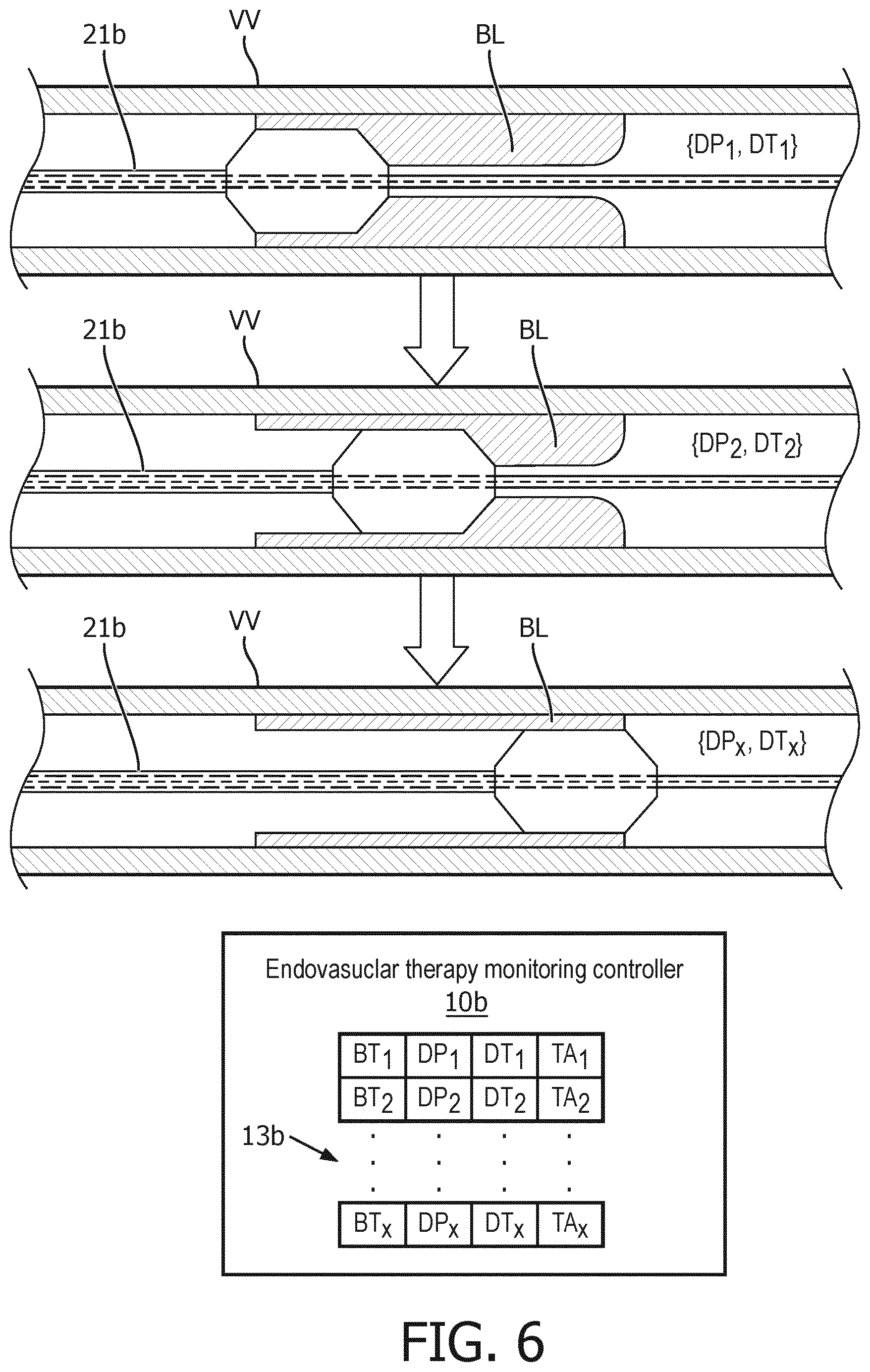 Patent US12551291 Figure 6 – Dwelling treatment monitoring for endoluminal therapy procedures