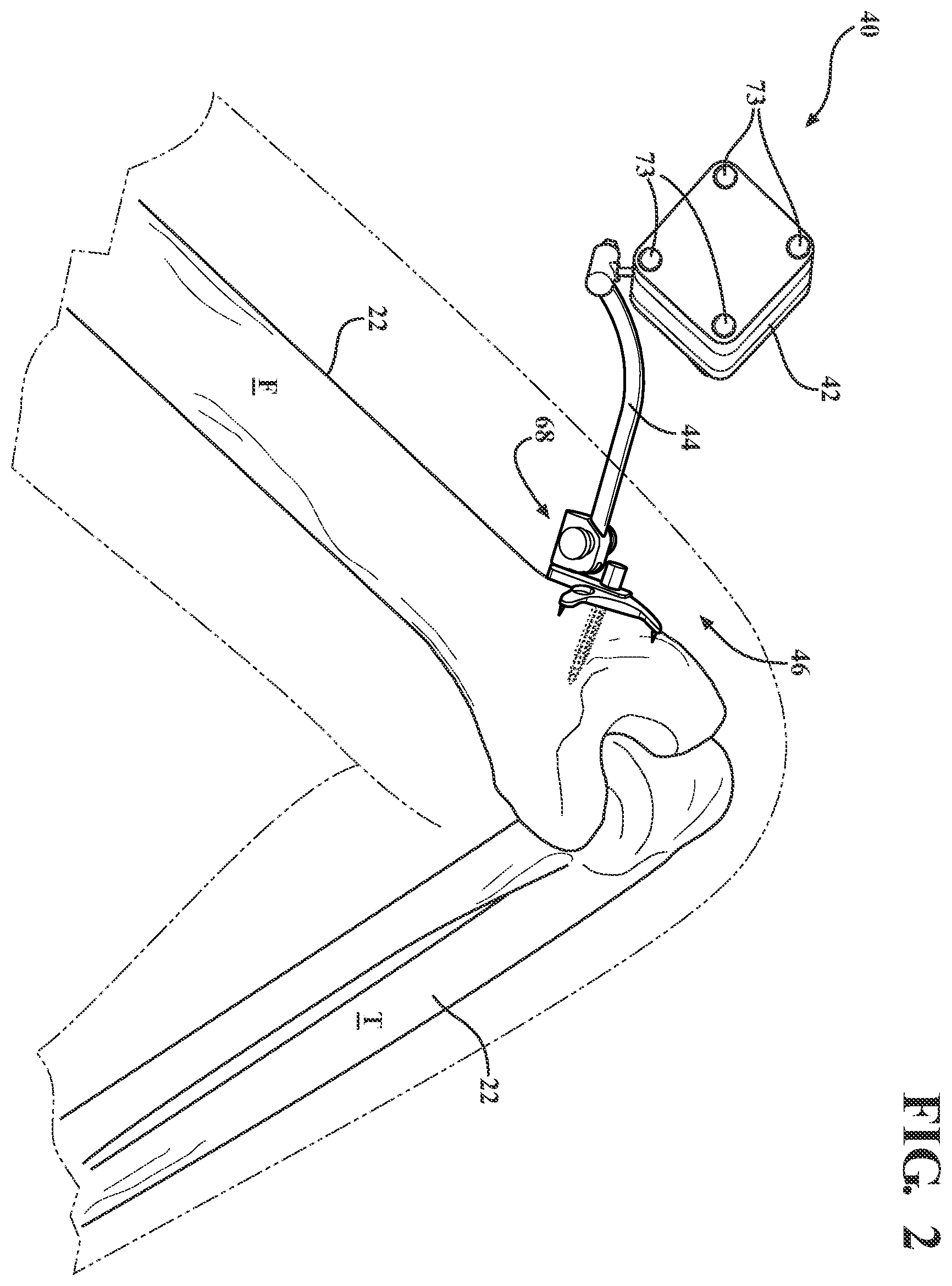 Patent US12551292 Figure 2 – Connector assembly and method for attaching a tracker body to a tracker support arm