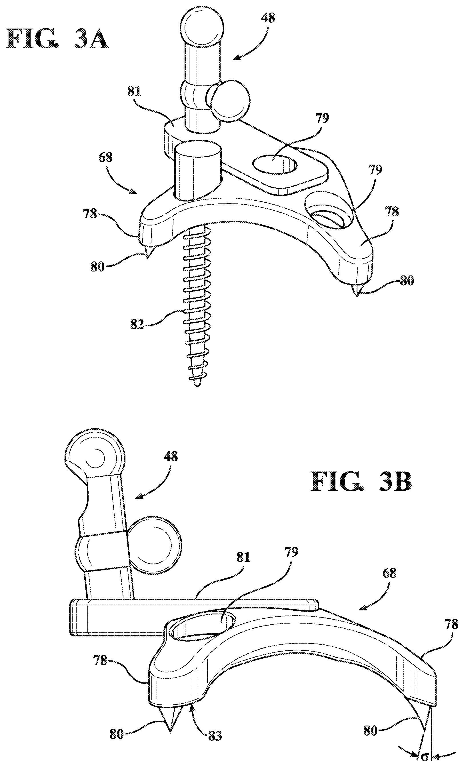 Patent US12551292 Figure 4 – Connector assembly and method for attaching a tracker body to a tracker support arm