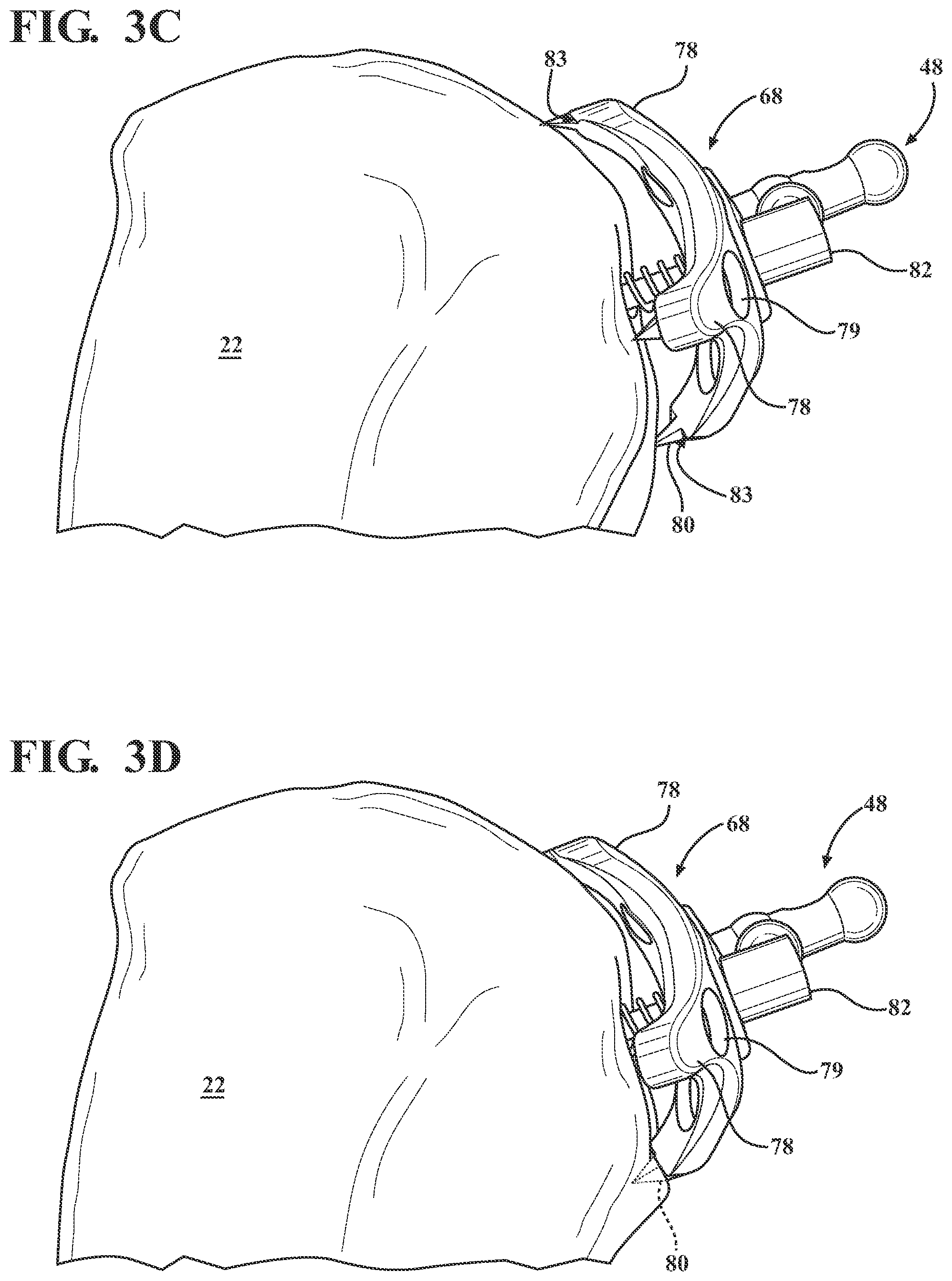 Patent US12551292 Figure 5 – Connector assembly and method for attaching a tracker body to a tracker support arm