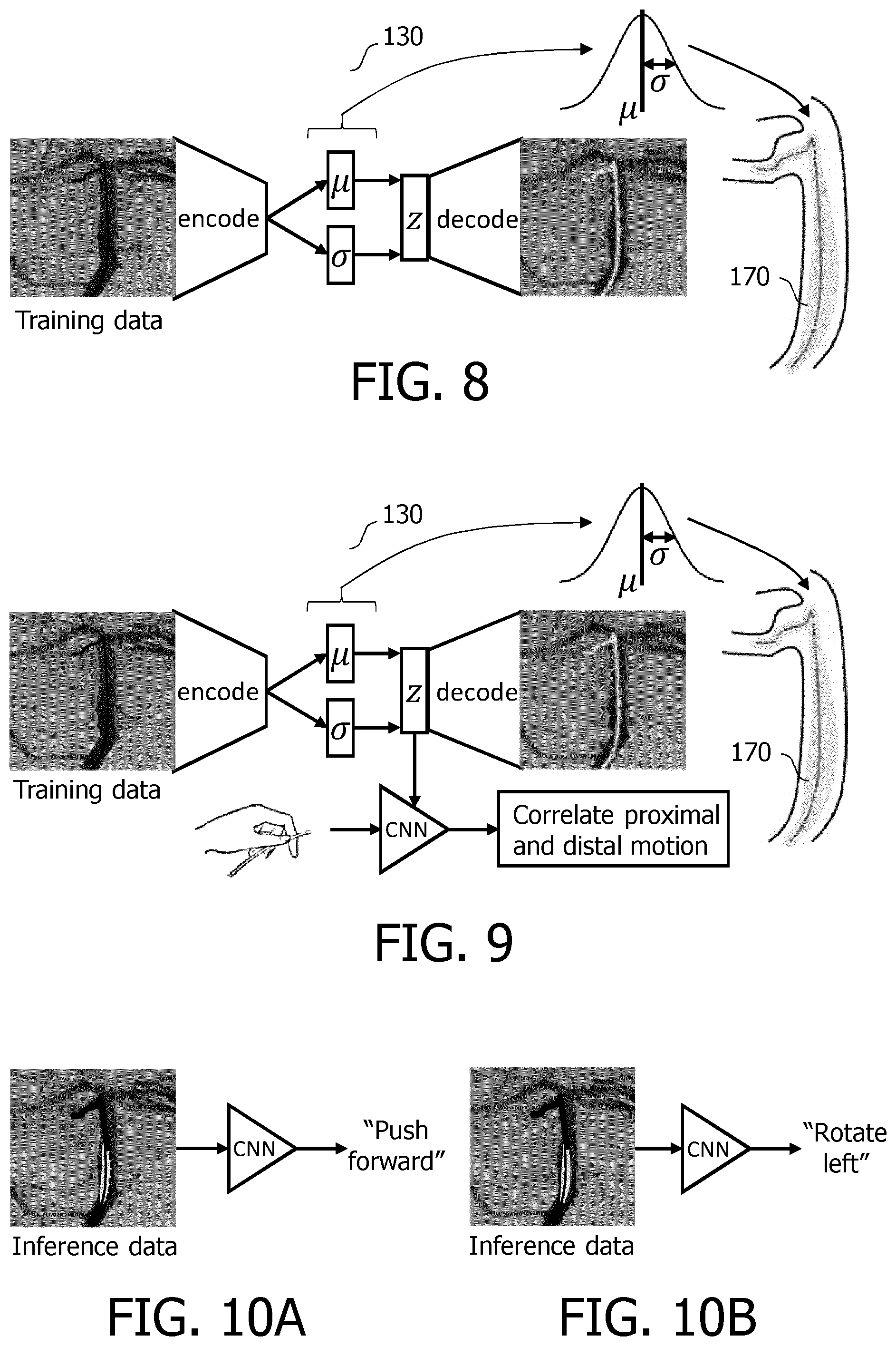 Patent US12551293 Figure 4 – Navigating an interventional device