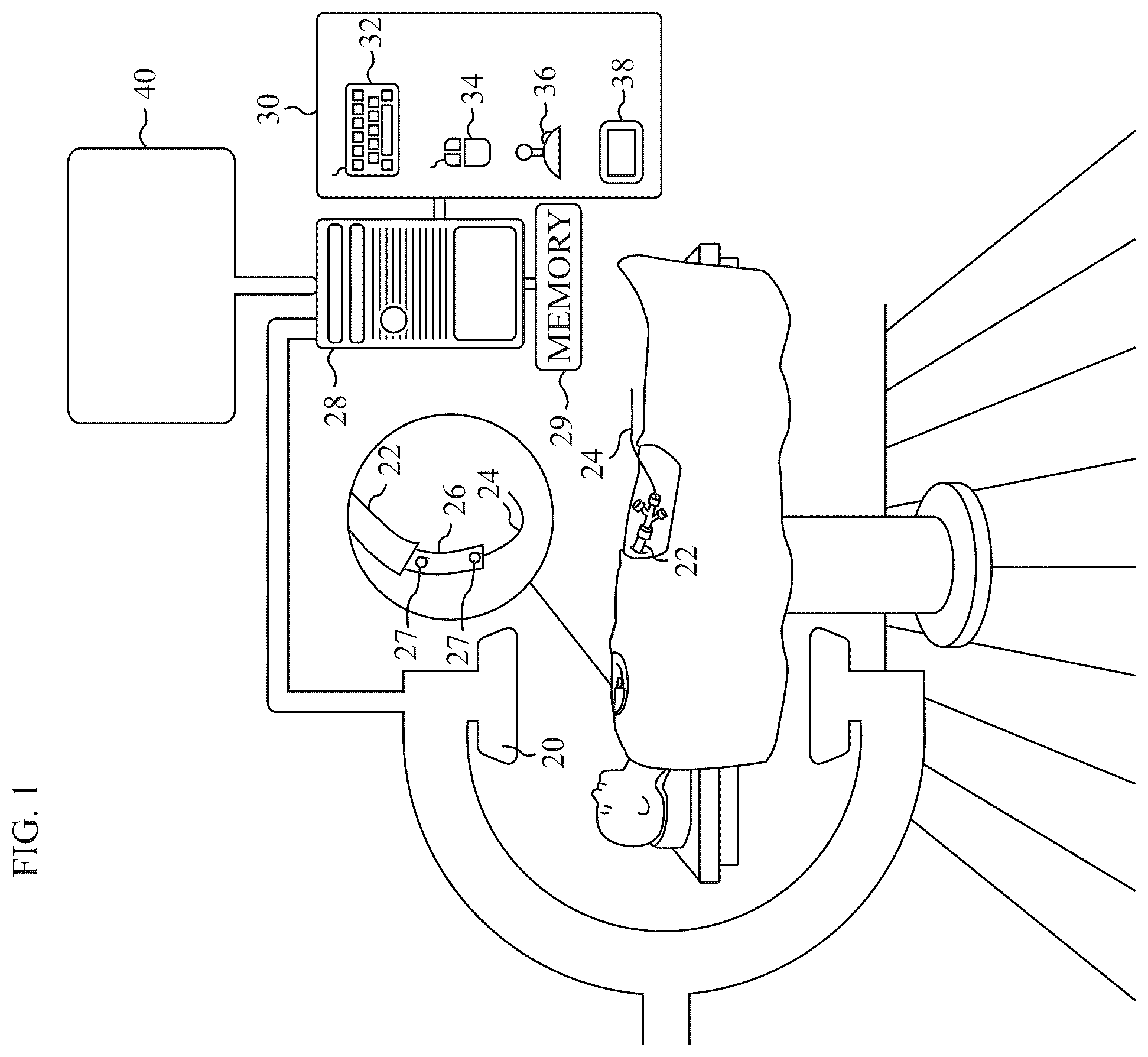 Patent US12551296 Figure 1 – Estimating the endoluminal path of an endoluminal device along a lumen
