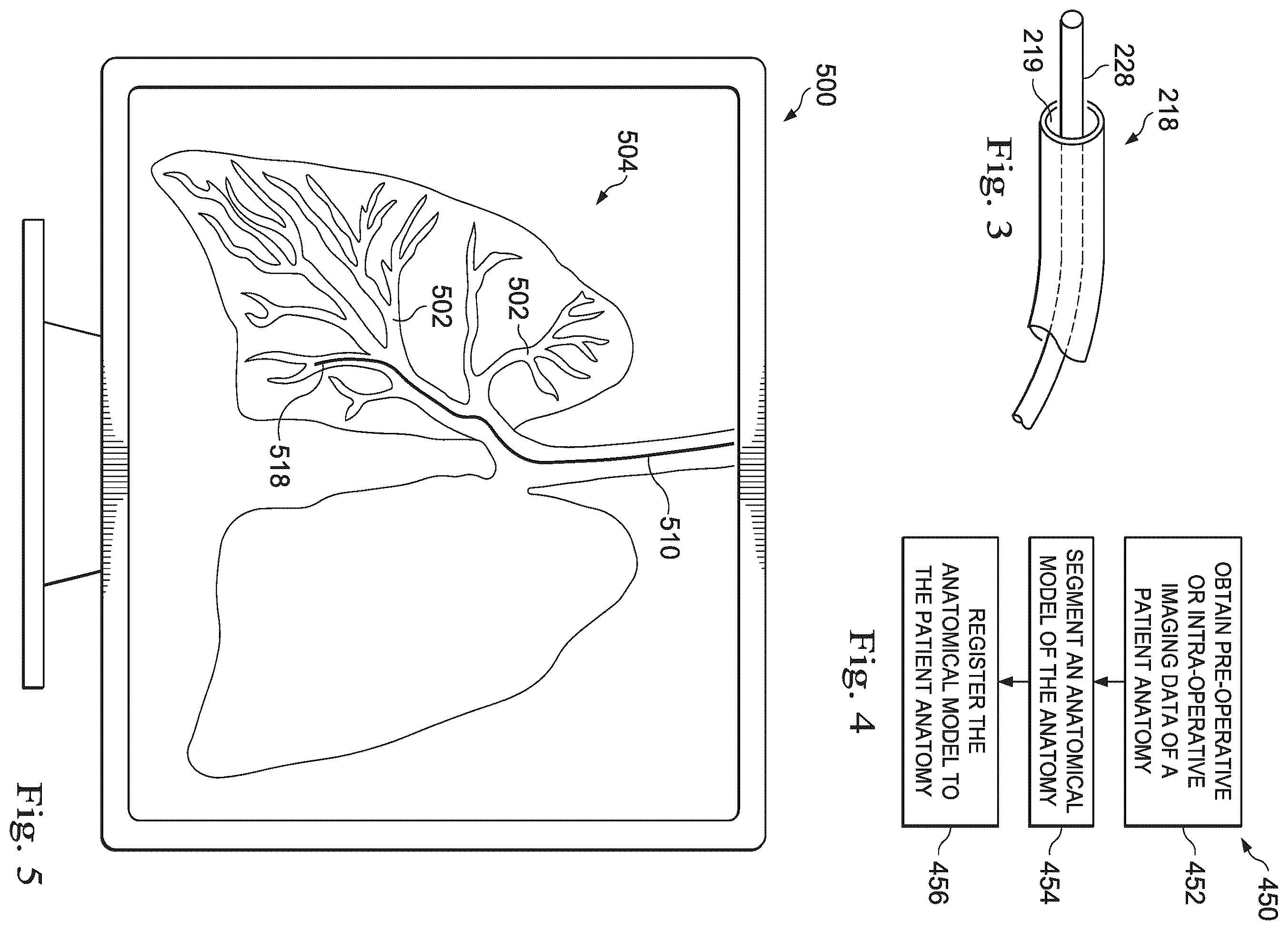 Patent US12551297 Figure 3 – Systems and methods of registration compensation in image guided surgery