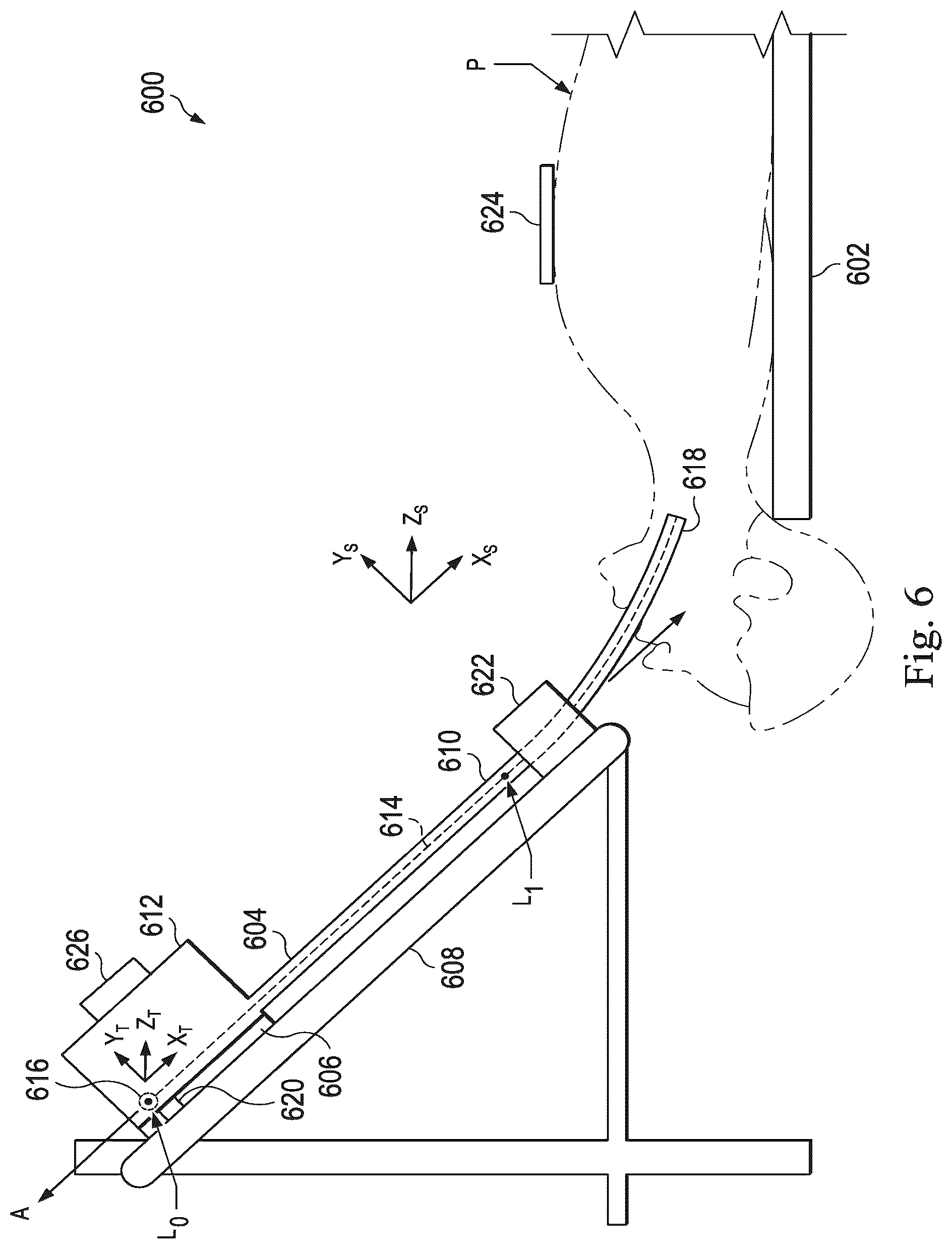 Patent US12551297 Figure 4 – Systems and methods of registration compensation in image guided surgery