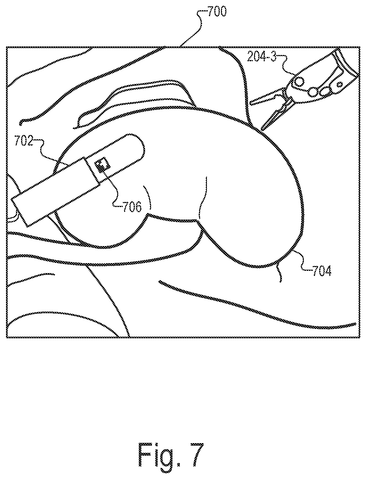 Patent US12551298 Figure 7 – Systems and methods for identifying and facilitating an intended interaction with a target object in a surgical space