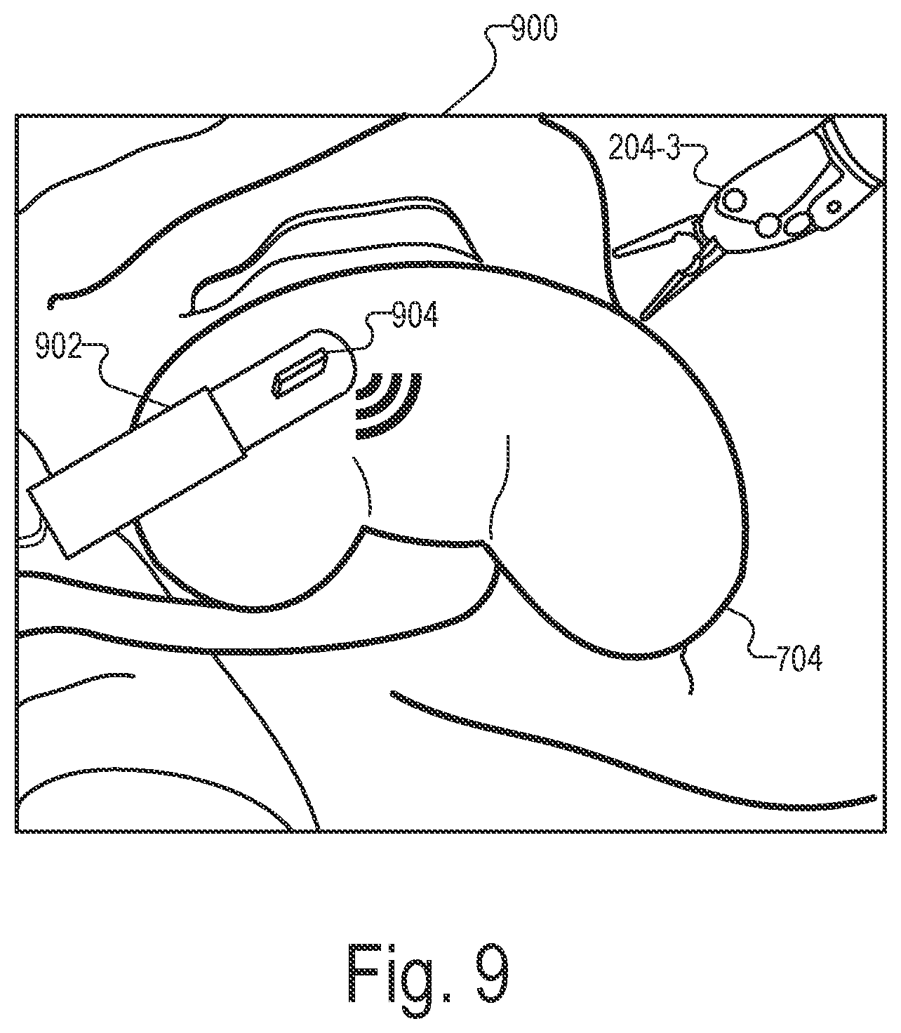 Patent US12551298 Figure 9 – Systems and methods for identifying and facilitating an intended interaction with a target object in a surgical space