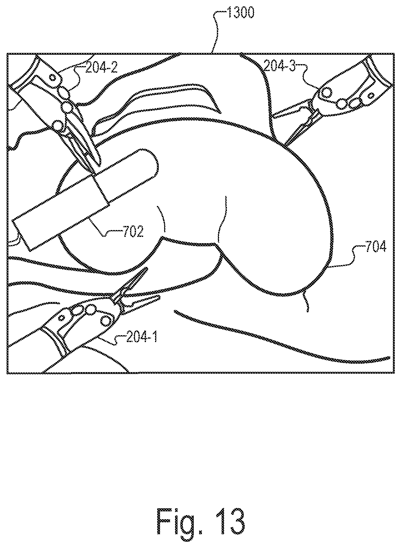 Patent US12551298 Figure 13 – Systems and methods for identifying and facilitating an intended interaction with a target object in a surgical space