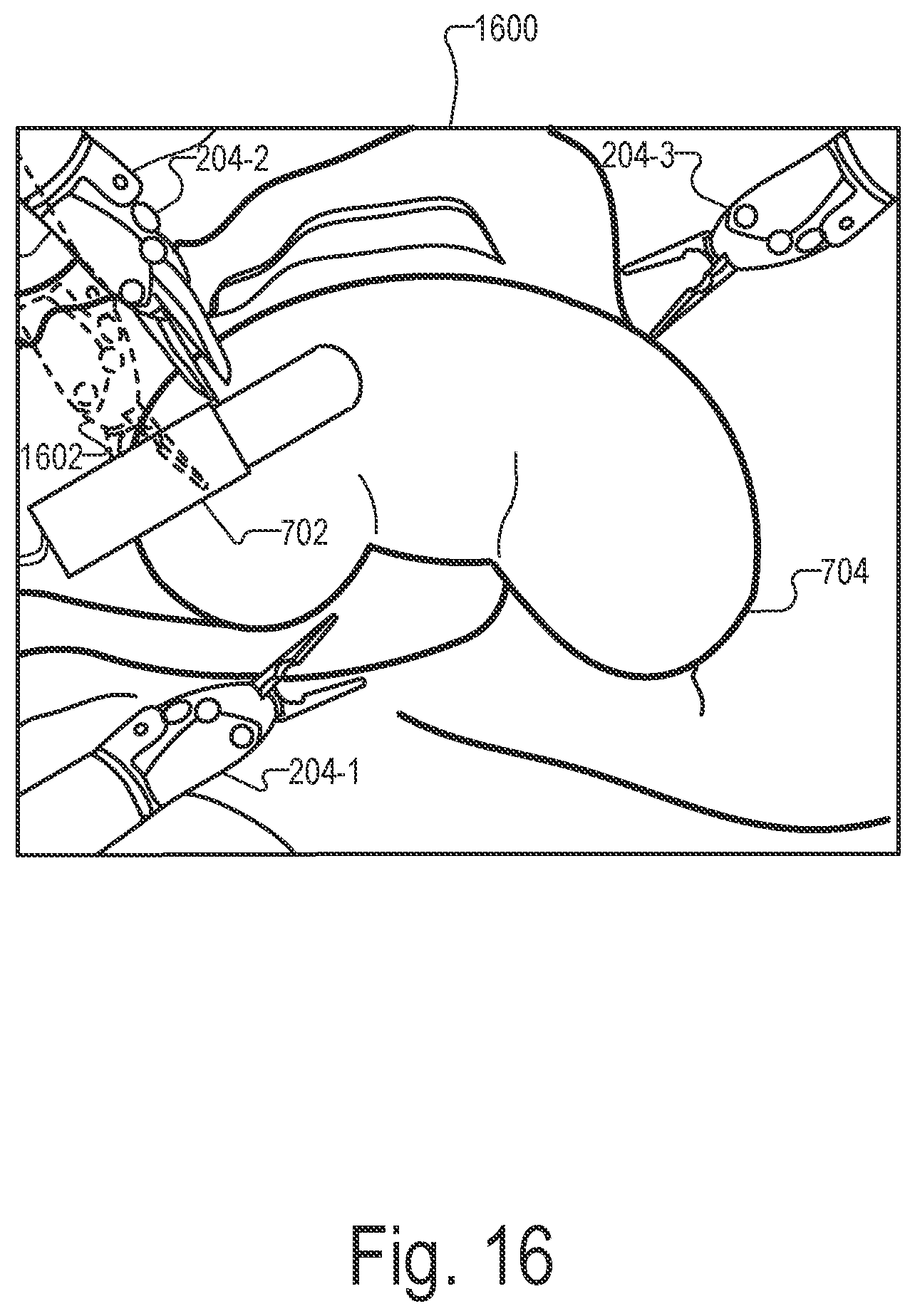 Patent US12551298 Figure 16 – Systems and methods for identifying and facilitating an intended interaction with a target object in a surgical space