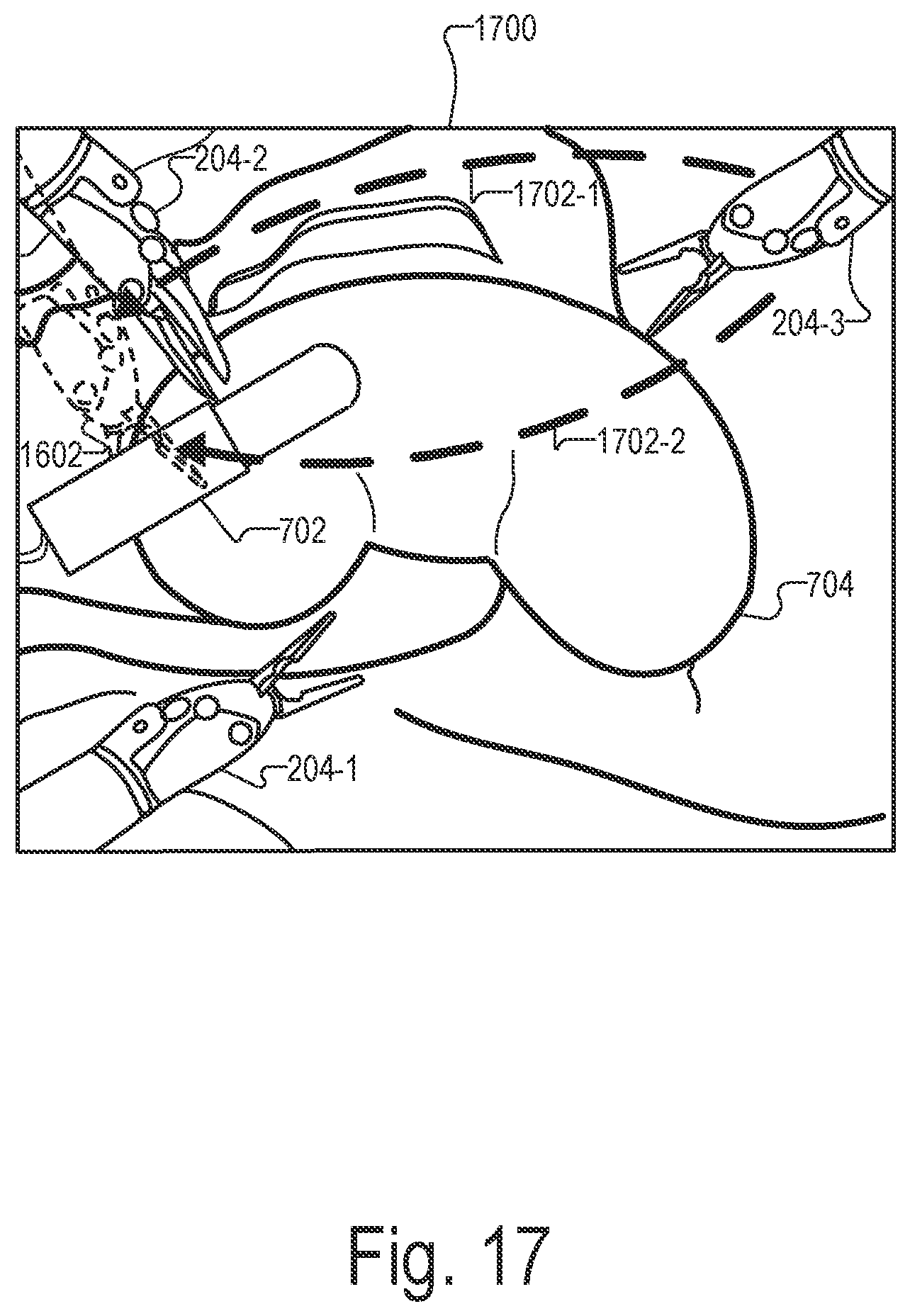 Patent US12551298 Figure 17 – Systems and methods for identifying and facilitating an intended interaction with a target object in a surgical space
