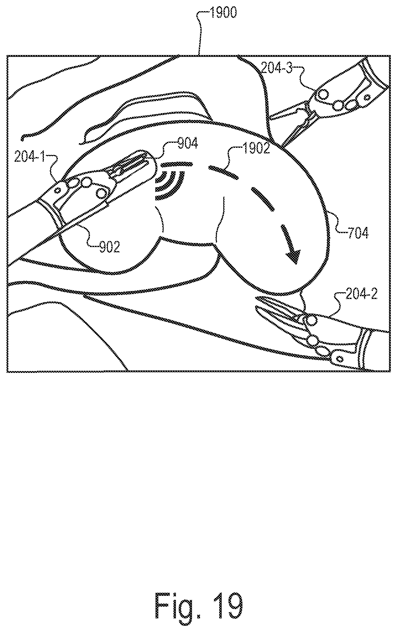 Patent US12551298 Figure 19 – Systems and methods for identifying and facilitating an intended interaction with a target object in a surgical space
