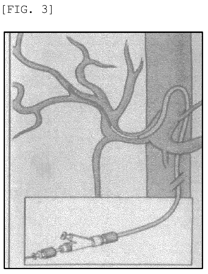 Patent US12551303 Figure 3 – Vascular interventional surgery robot having multi-contact plate, and vascular interventional surgery system