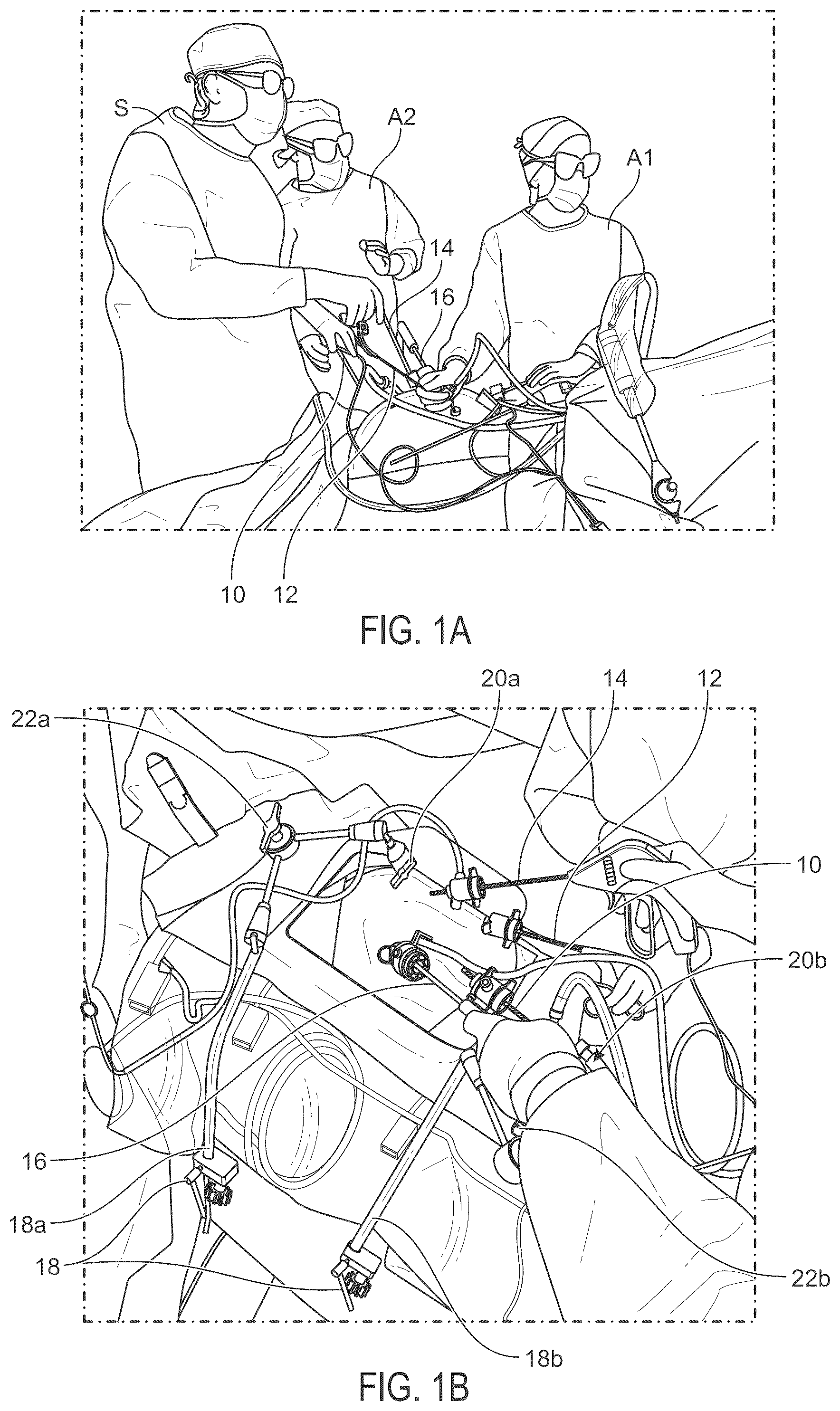 Patent US12551304 Figure 1 – Co-manipulation surgical system for use with surgical instruments for performing surgery according to stored surgeon's preferences